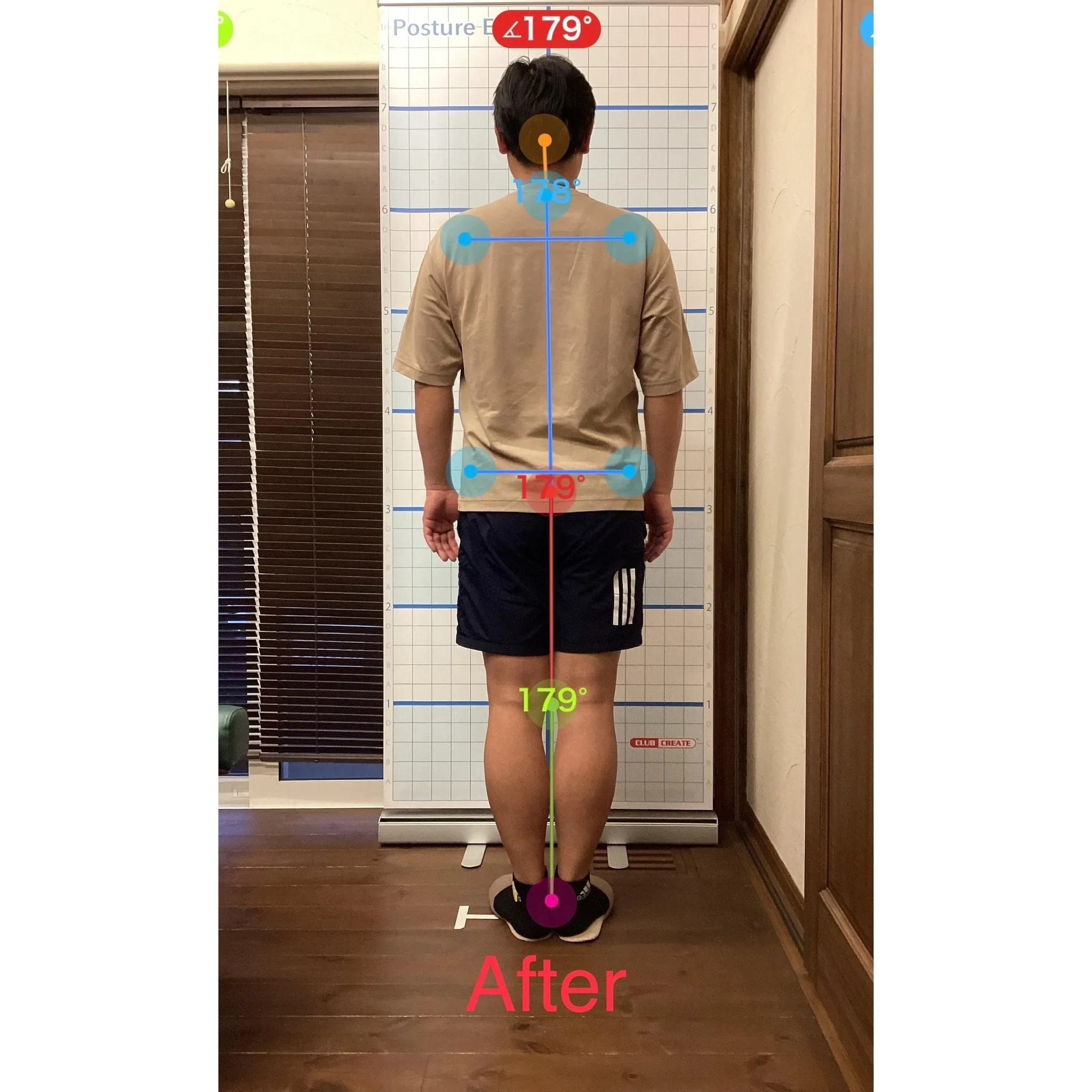 【富里 整体】左肩の痛み、腰痛、背中のシビレ 他/30代男性...