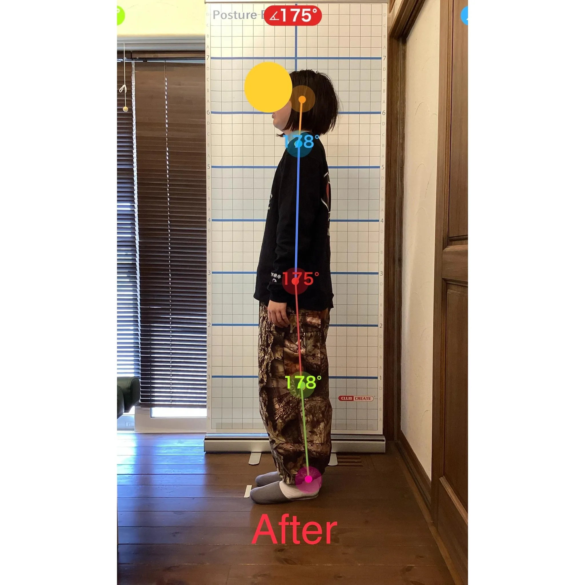 【富里 整体】腰痛、肩こり、背中の張り 他/20代女性/会社...