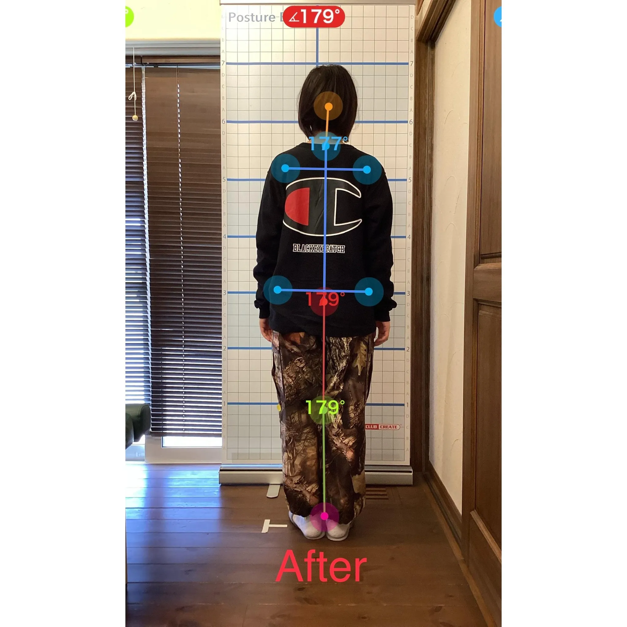 【富里 整体】腰痛、肩こり、背中の張り 他/20代女性/会社...