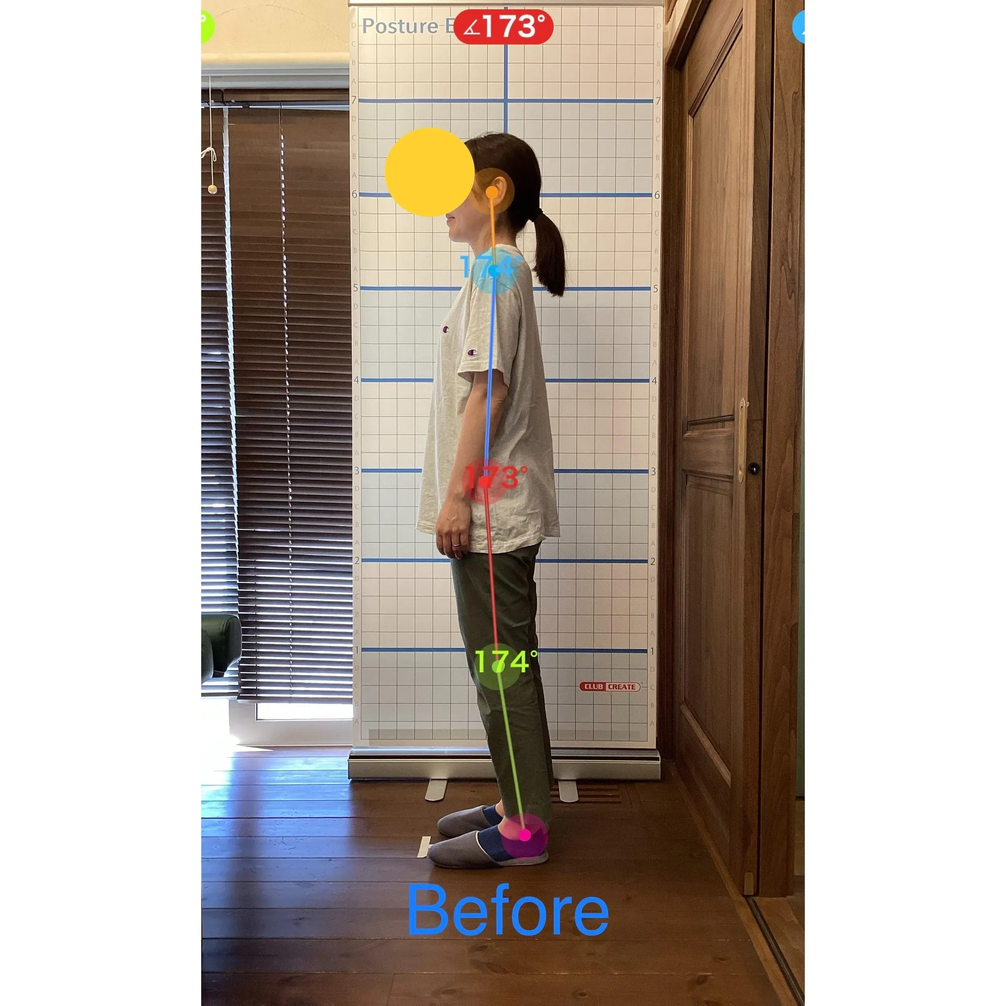 【富里 整体】背中の痛み、肩こり、臀部の痛み/40代女性/介...