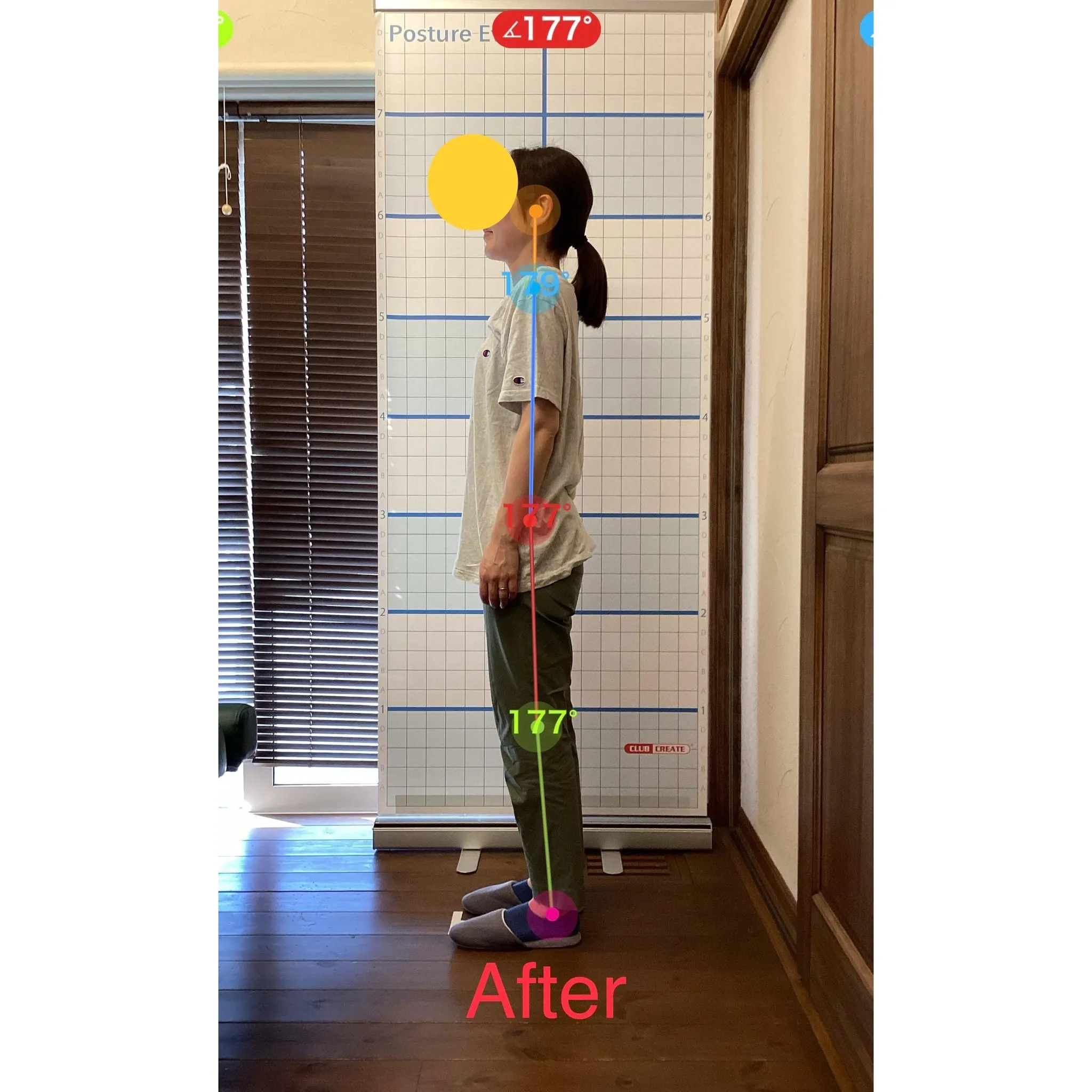 【富里 整体】背中の痛み、肩こり、臀部の痛み/40代女性/介...