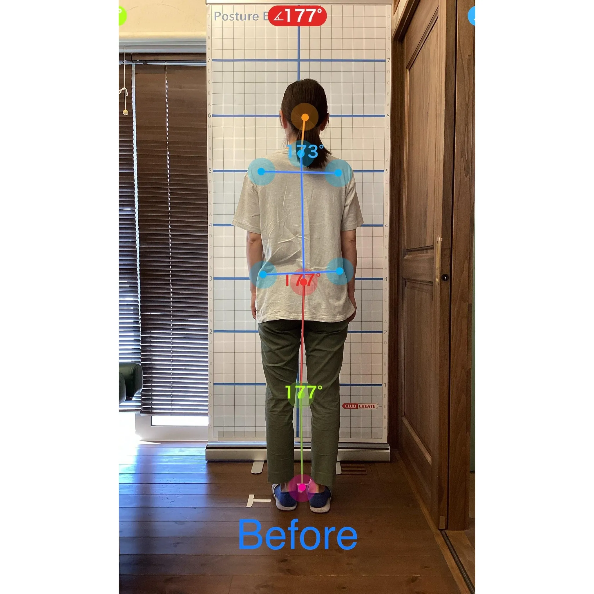 【富里 整体】背中の痛み、肩こり、臀部の痛み/40代女性/介...