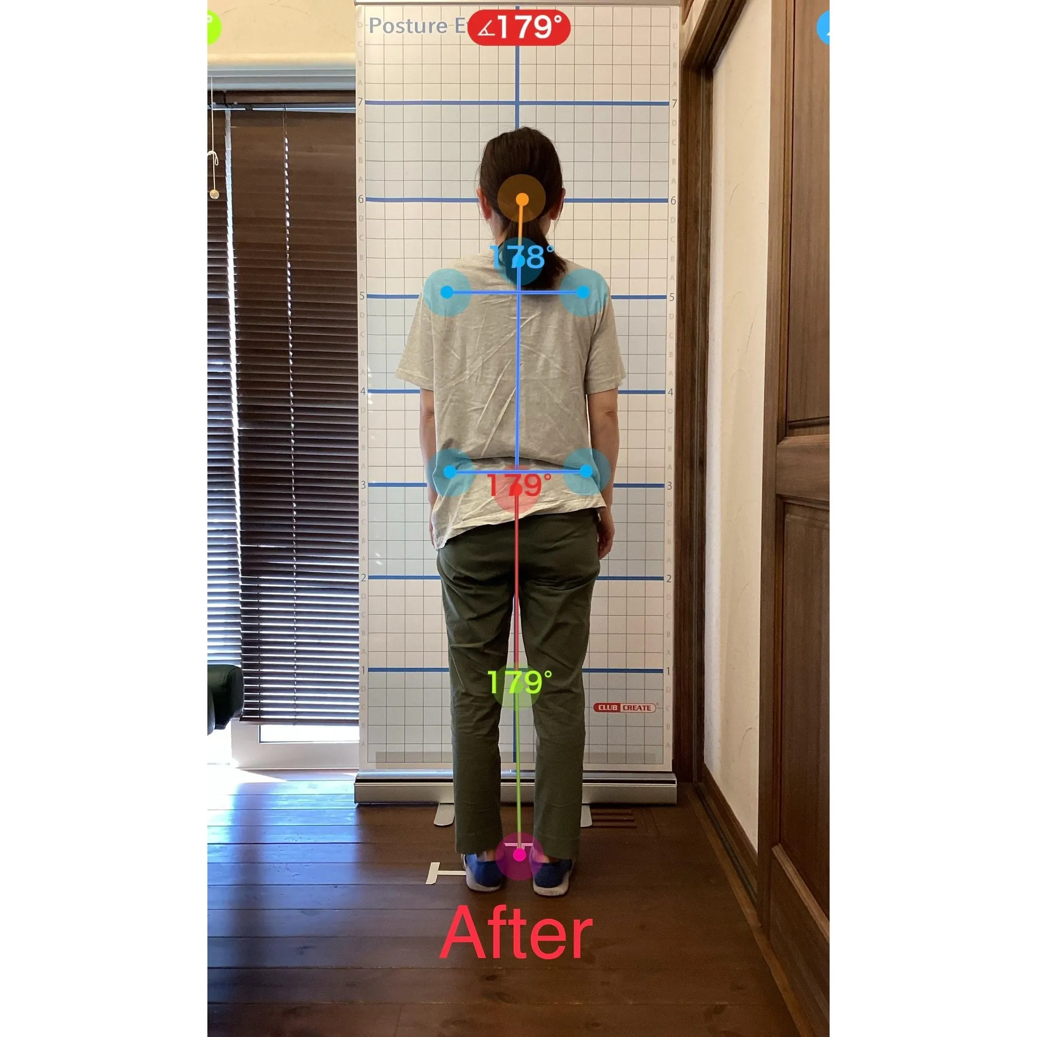 【富里 整体】背中の痛み、肩こり、臀部の痛み/40代女性/介...