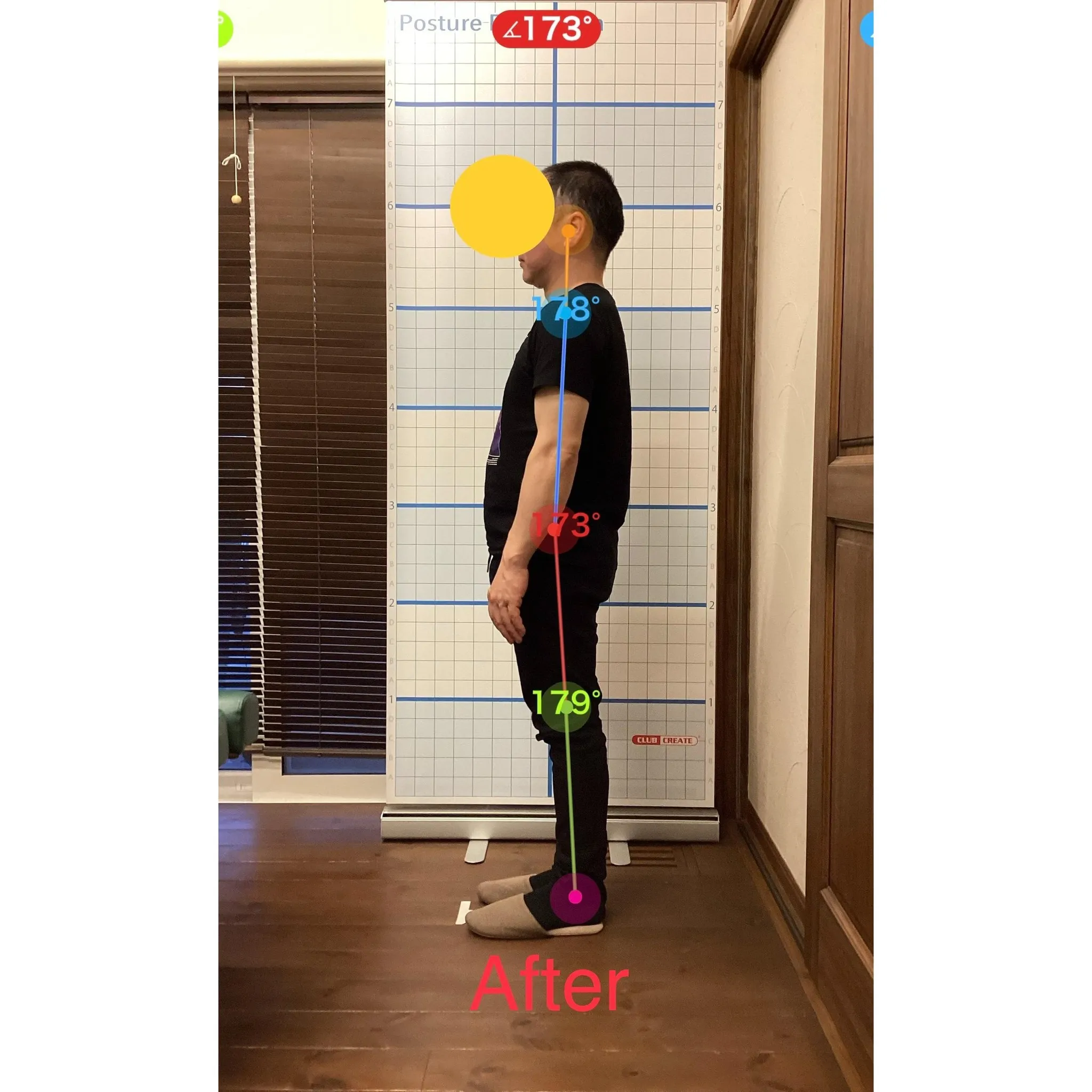 【富里 整体】肩の痛み、肩こり、首こり 他/40代男性/会社...