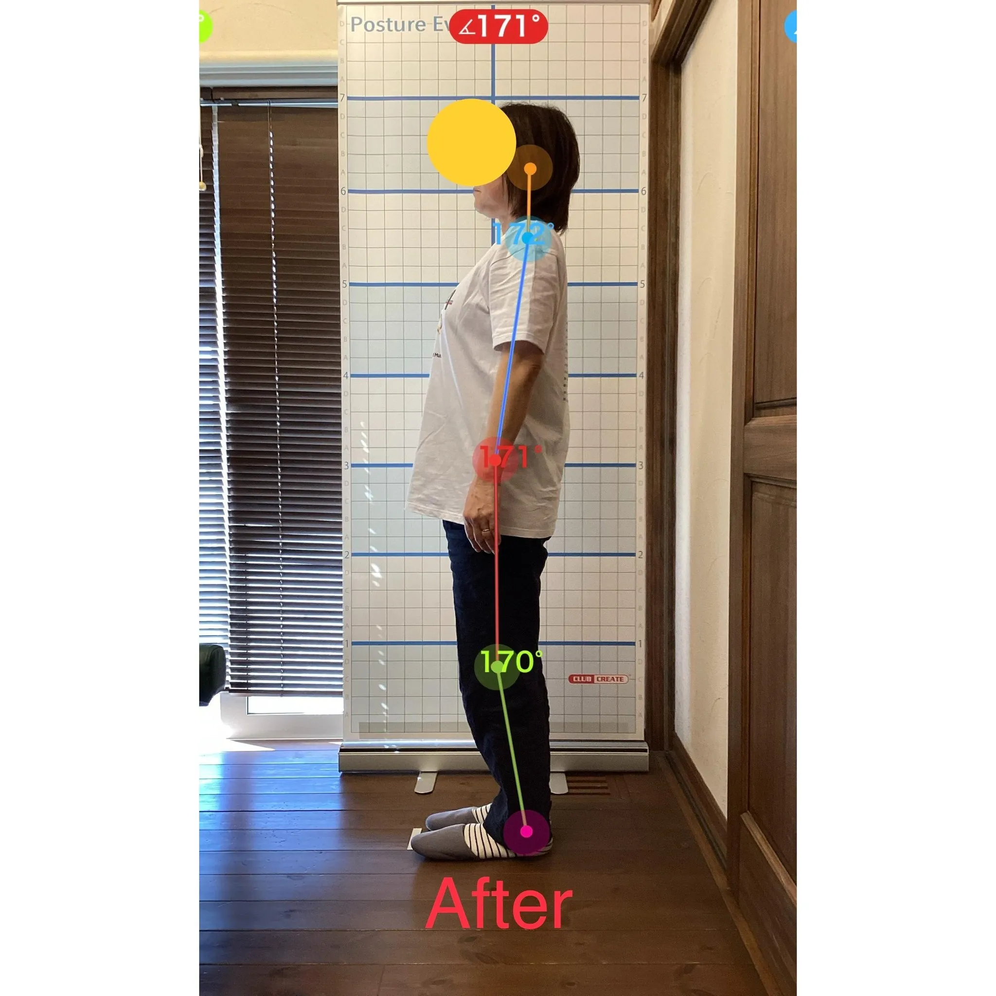 【富里 整体】姿勢改善、肩こり、腰痛 他/50代女性/ウェイ...