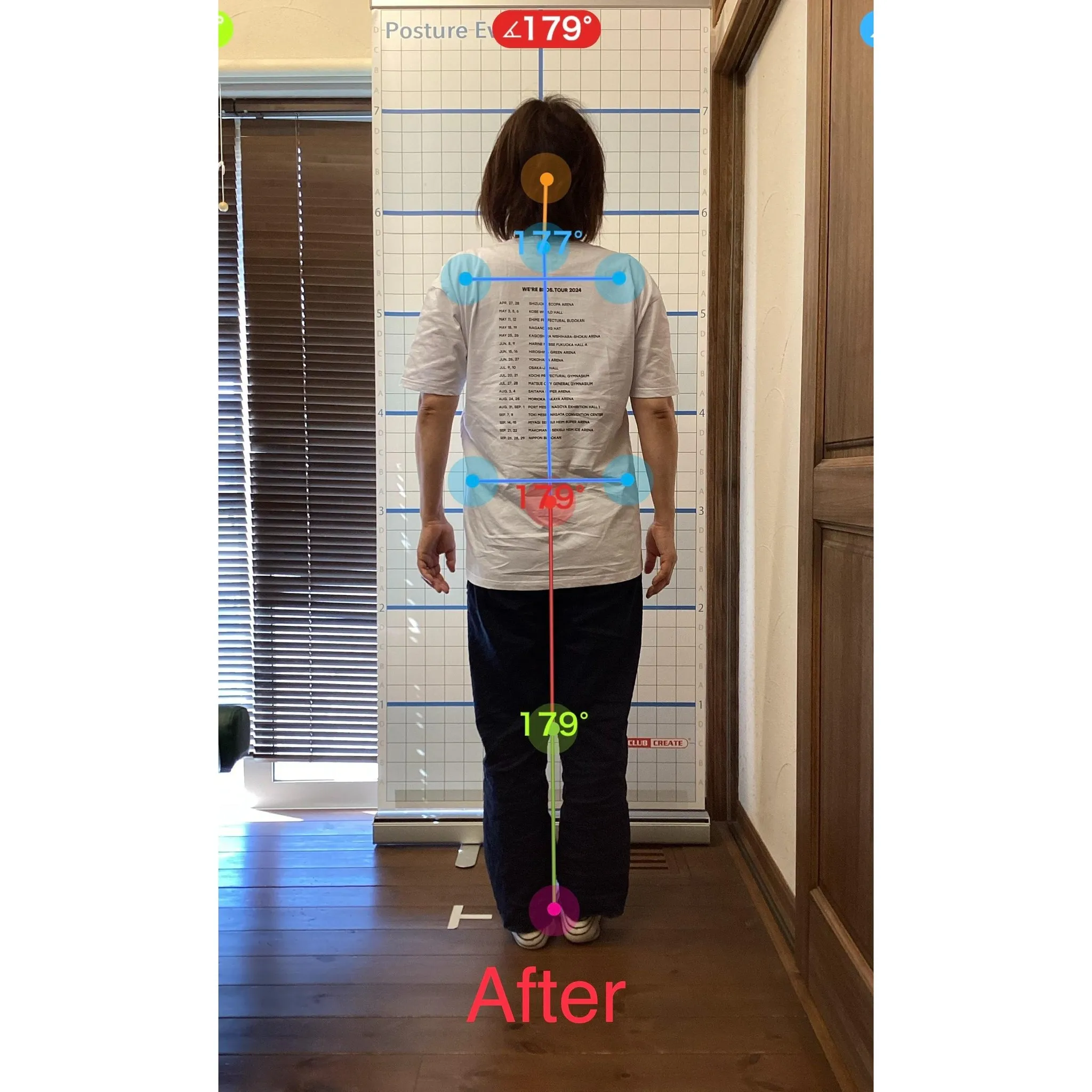 【富里 整体】姿勢改善、肩こり、腰痛 他/50代女性/ウェイ...