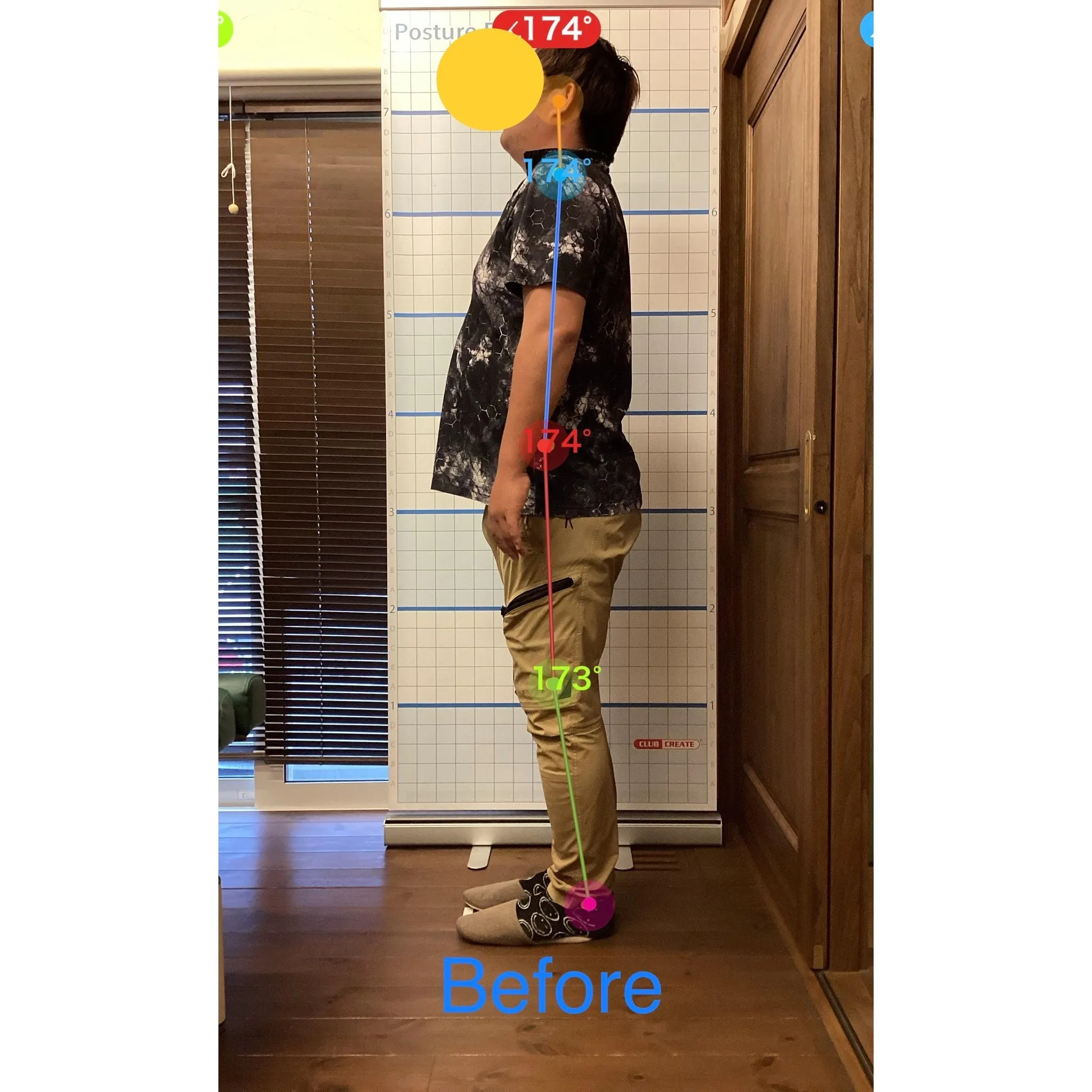 【富里 整体】腰痛、脊椎分離症、頭痛 他/30代男性/建設業