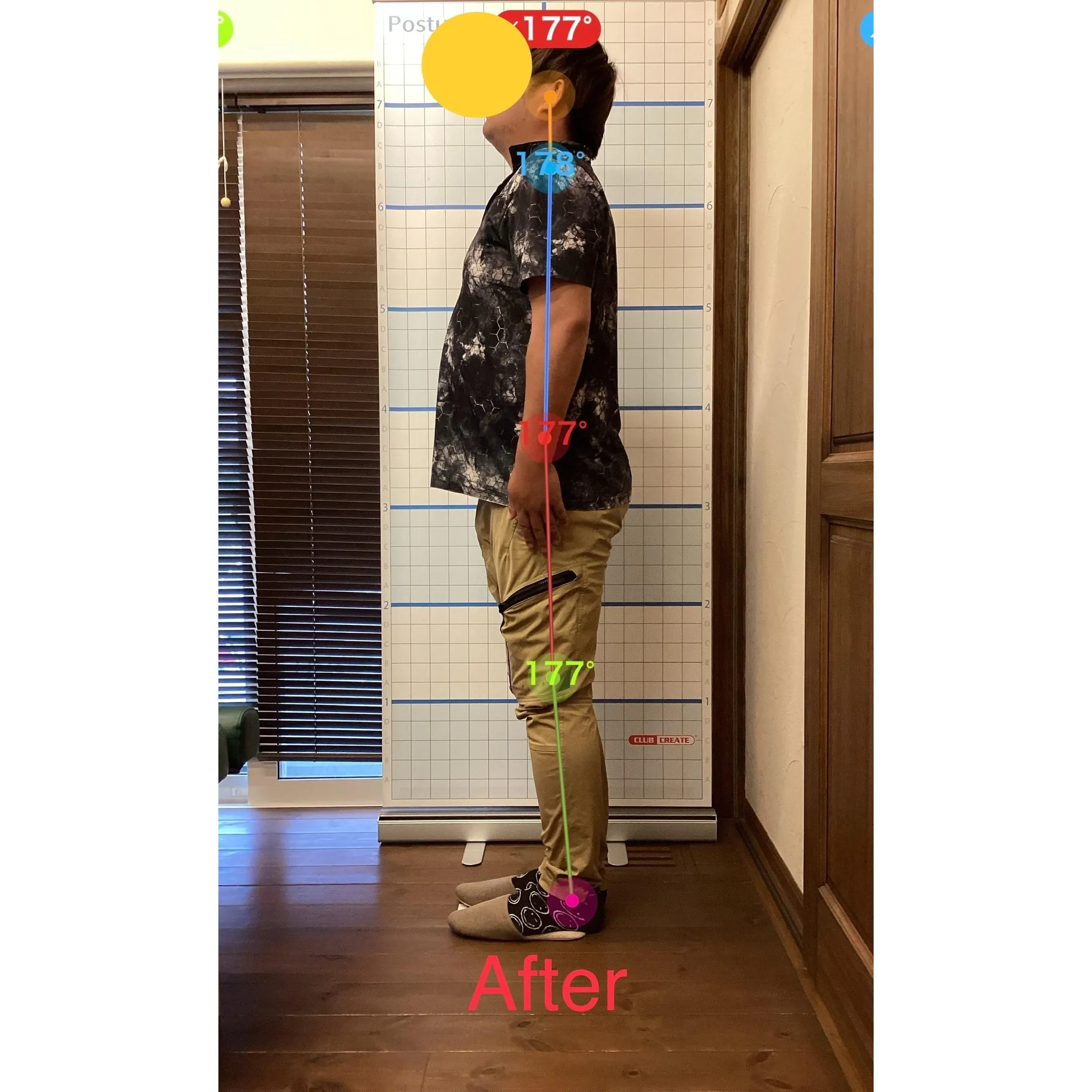 【富里 整体】腰痛、脊椎分離症、頭痛 他/30代男性/建設業