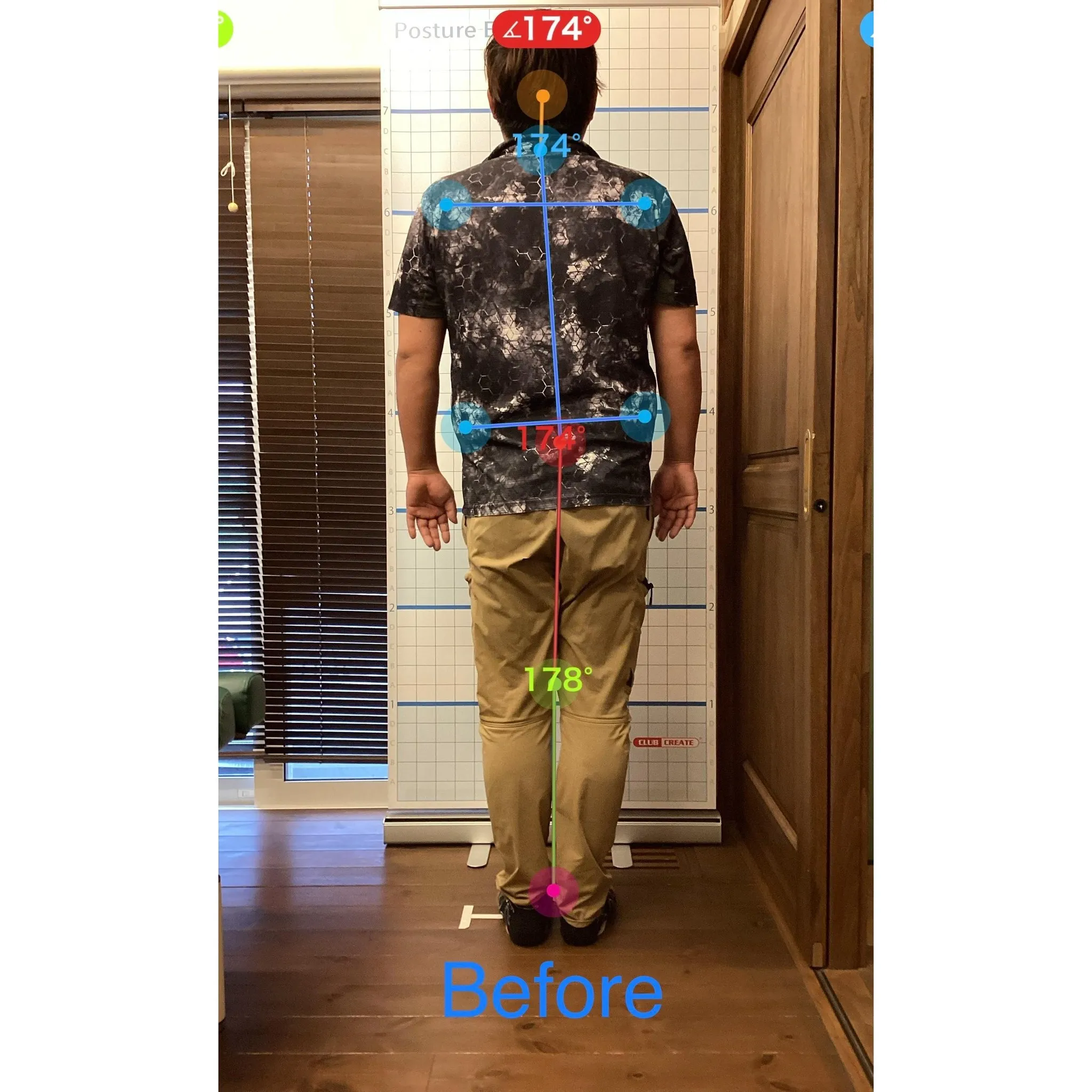 【富里 整体】腰痛、脊椎分離症、頭痛 他/30代男性/建設業