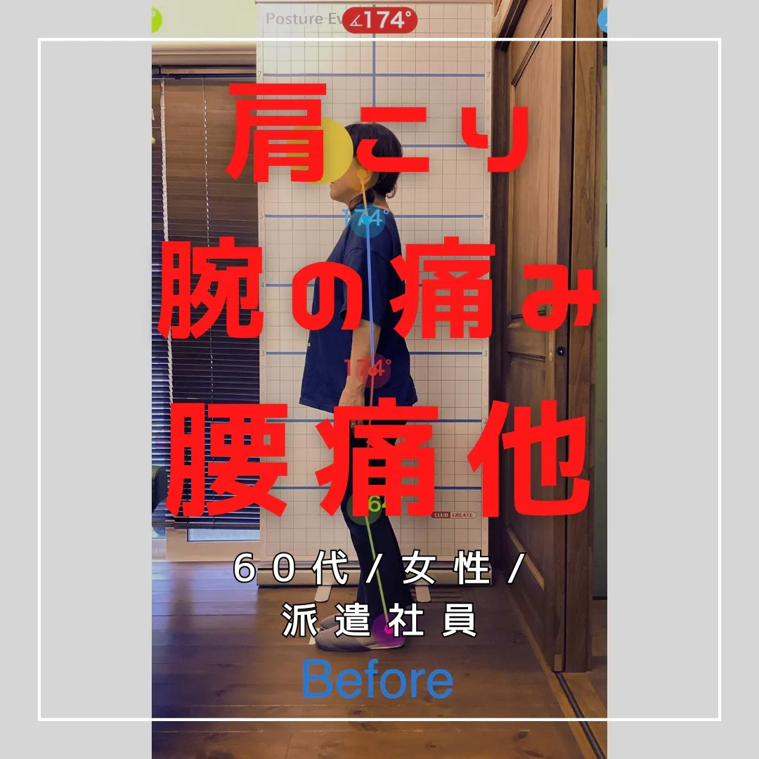 【富里 整体】腰痛、肩こり、腕の痛み/60代女性/派遣社員