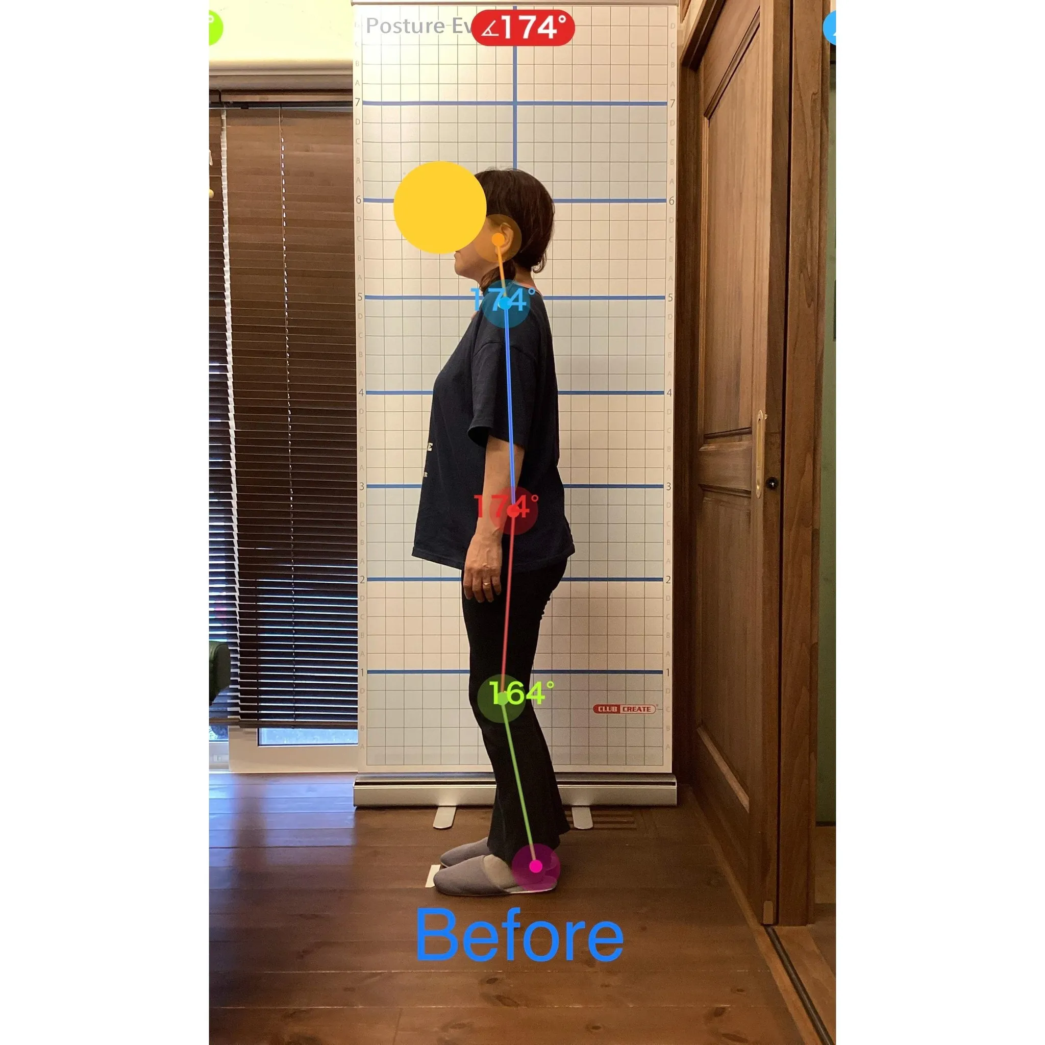 【富里 整体】腰痛、肩こり、腕の痛み/60代女性/派遣社員