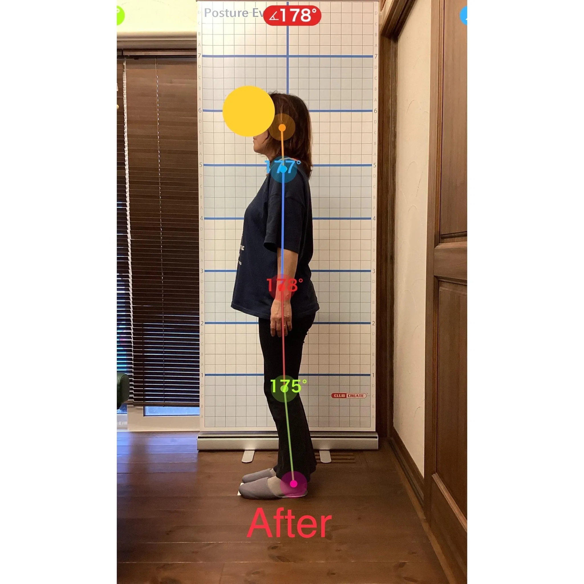 【富里 整体】腰痛、肩こり、腕の痛み/60代女性/派遣社員