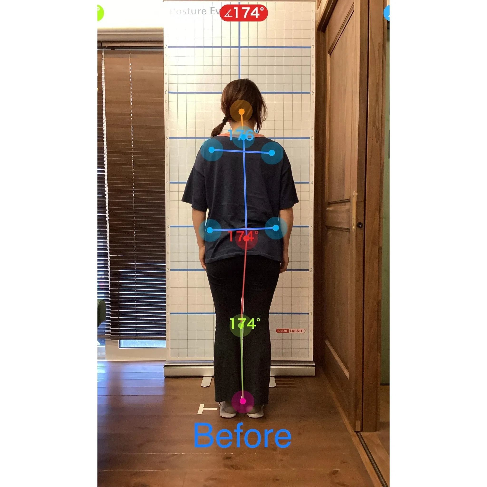【富里 整体】腰痛、肩こり、腕の痛み/60代女性/派遣社員