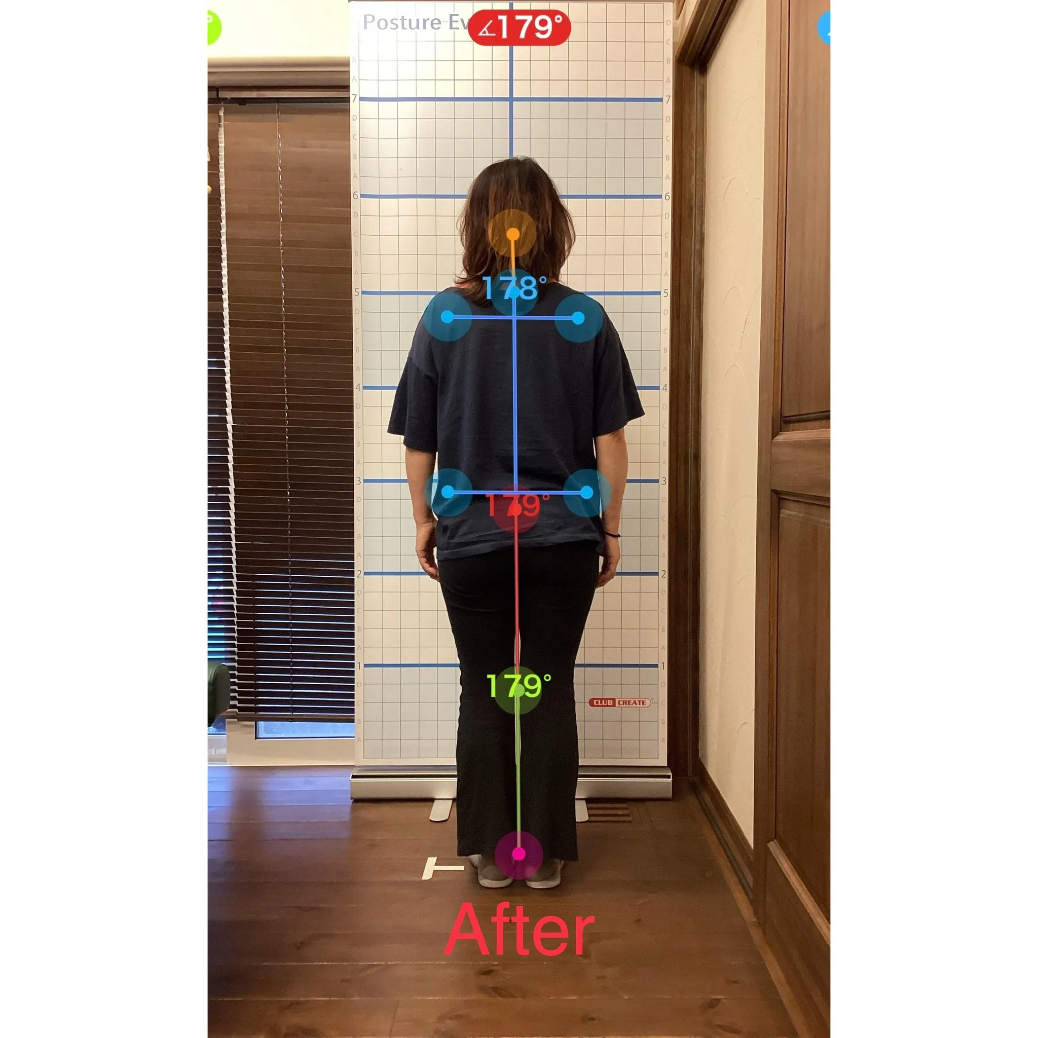 【富里 整体】腰痛、肩こり、腕の痛み/60代女性/派遣社員