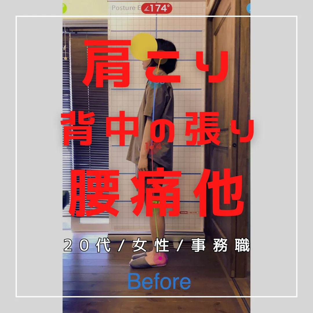 【富里 整体】腰痛、肩こり、背中の張り 他/20代女性/会社...