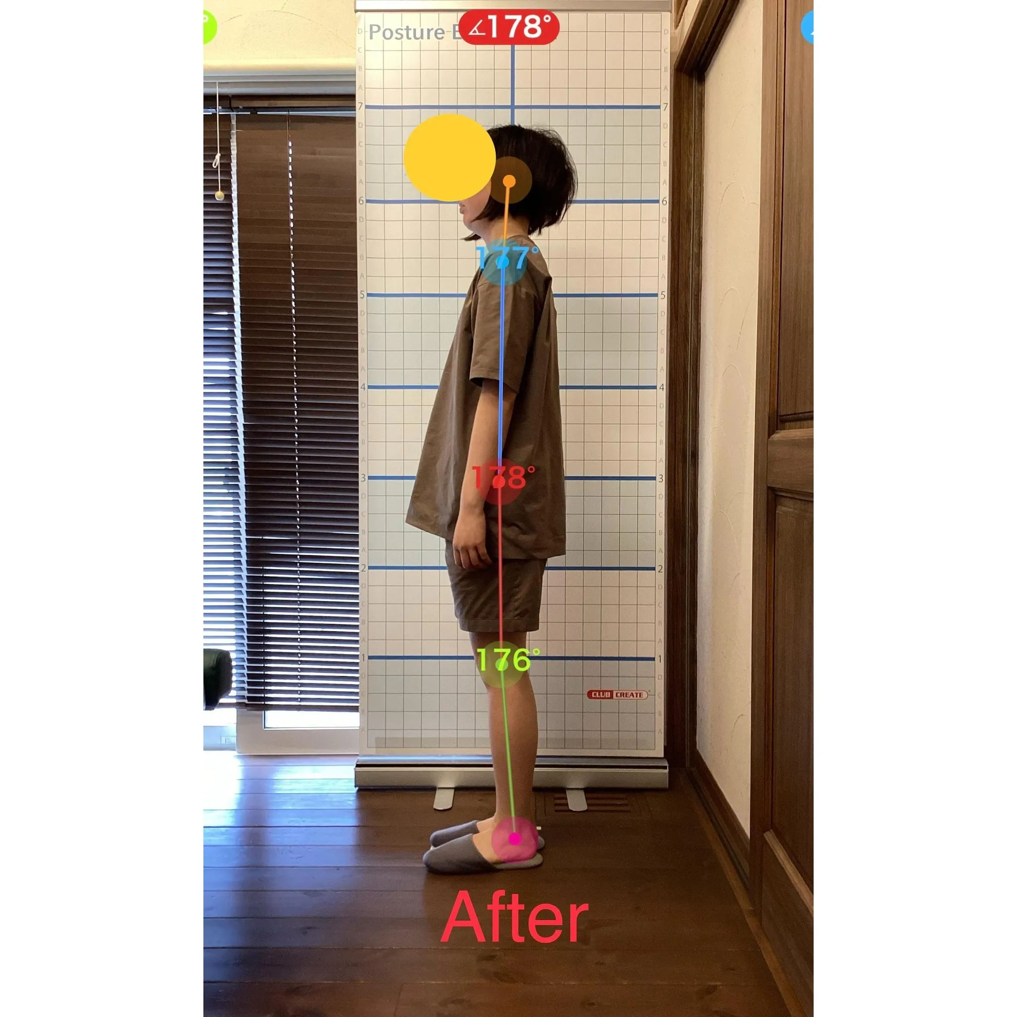 【富里 整体】腰痛、肩こり、背中の張り 他/20代女性/会社...