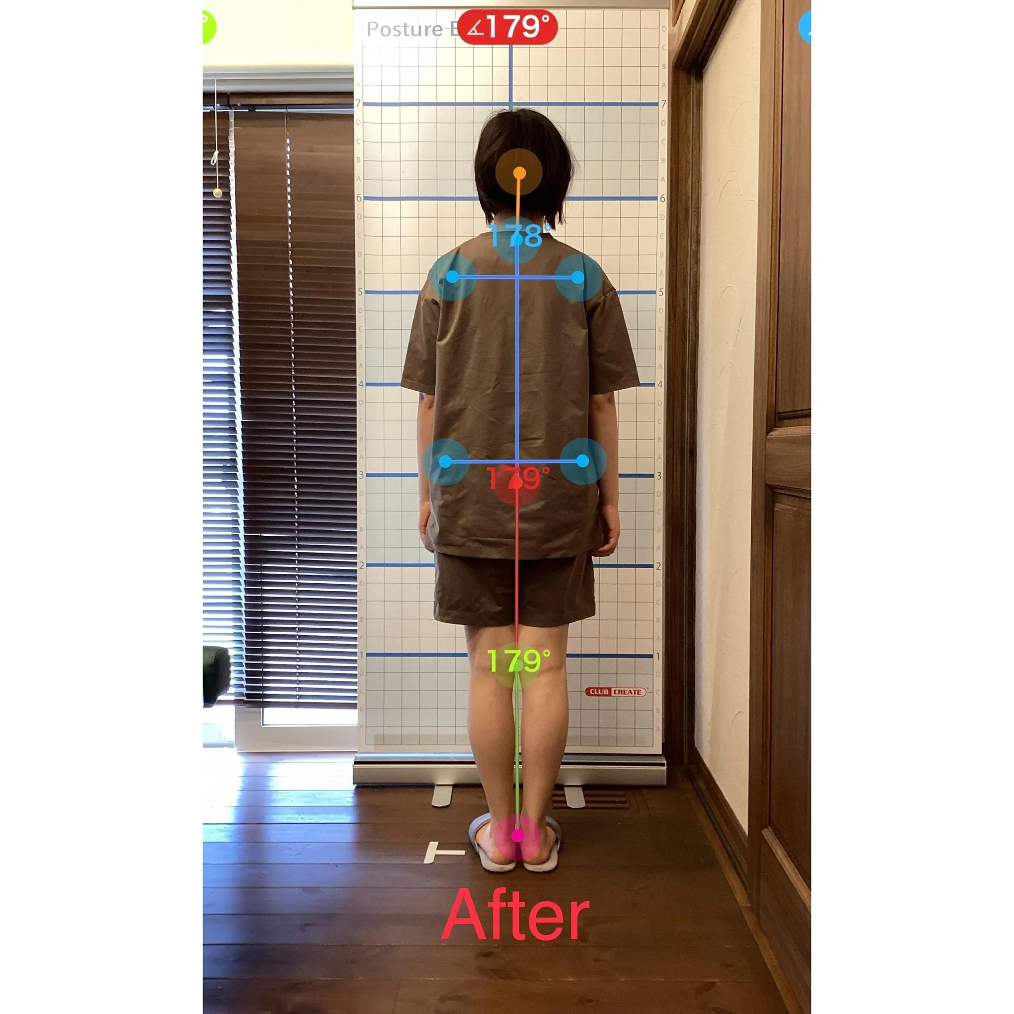 【富里 整体】腰痛、肩こり、背中の張り 他/20代女性/会社...