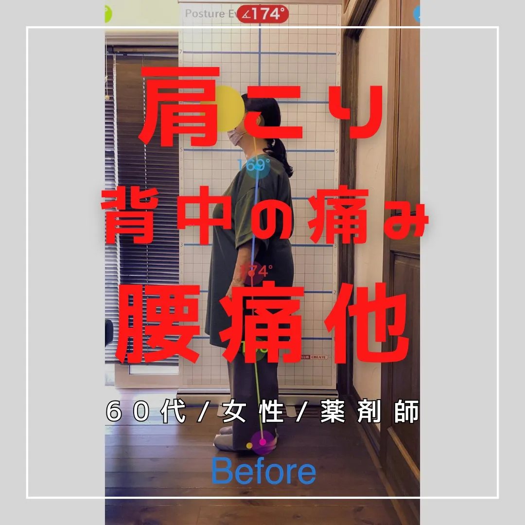 【富里 整体】腰痛、肩こり、背中の痛み 他/60代女性/薬剤...