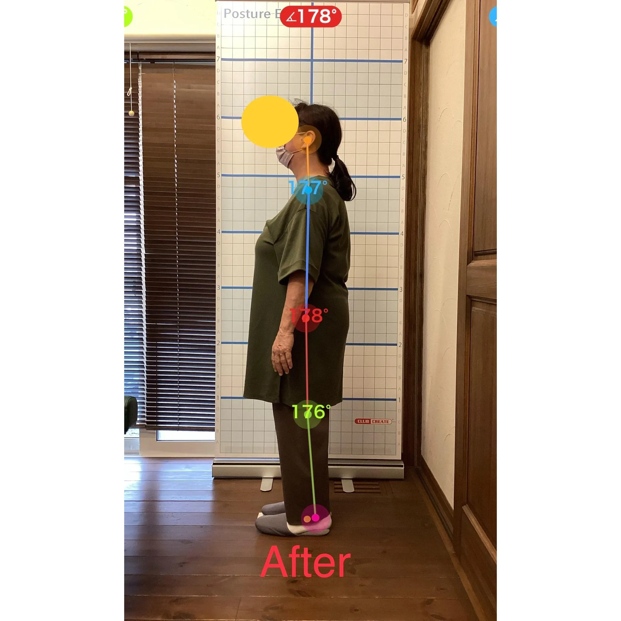 【富里 整体】腰痛、肩こり、背中の痛み 他/60代女性/薬剤...