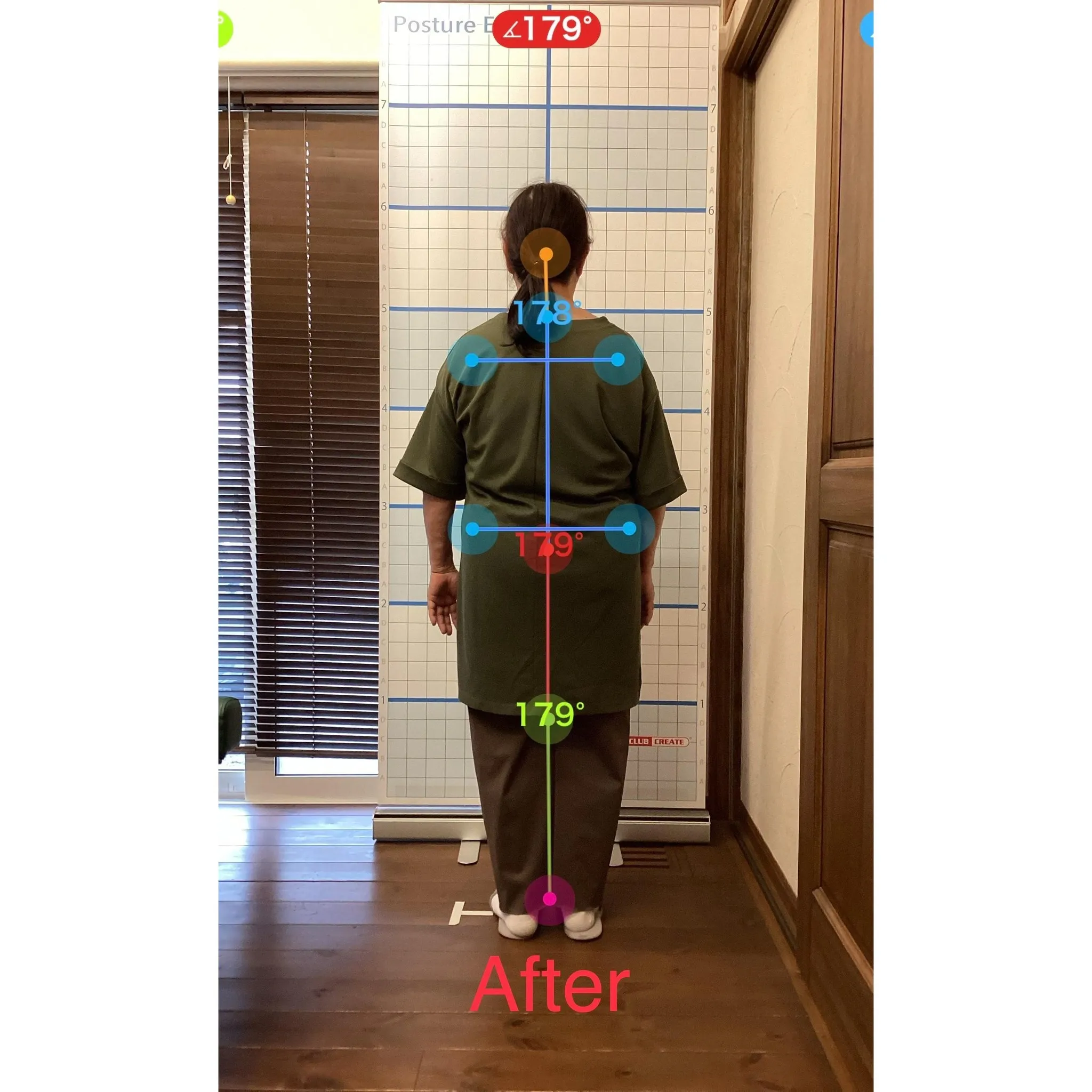 【富里 整体】腰痛、肩こり、背中の痛み 他/60代女性/薬剤...