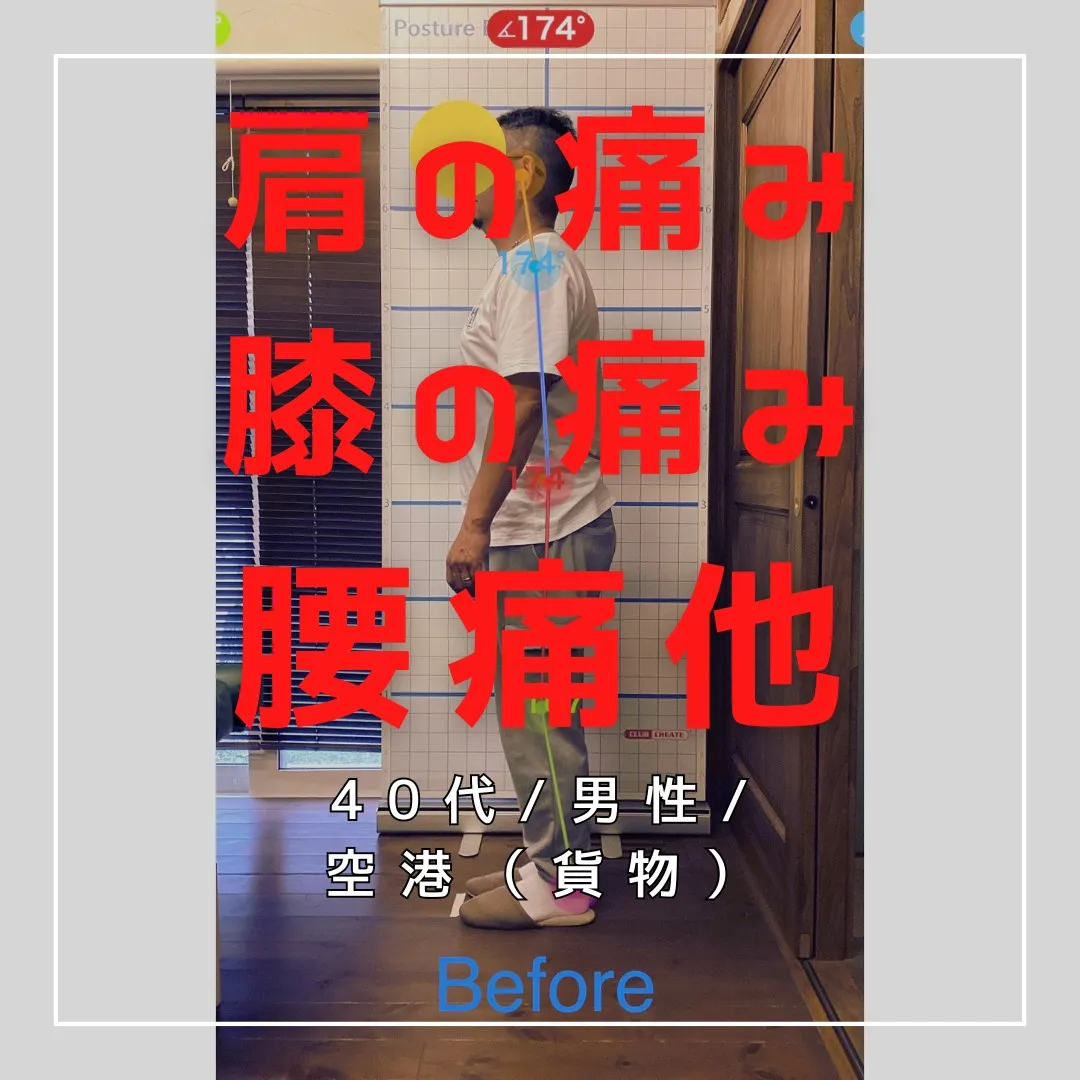 【富里 整体】腰痛、膝の痛み、肩の痛み 他/40代男性/空港...