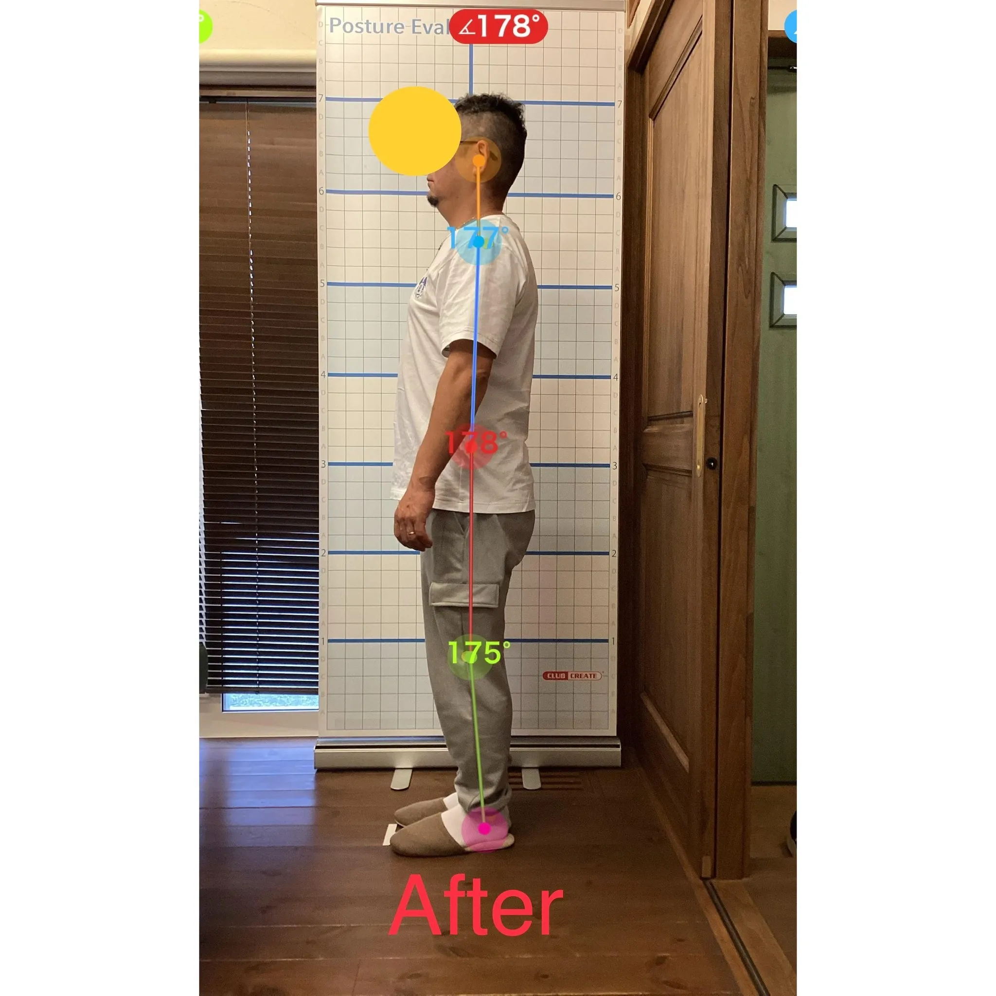 【富里 整体】腰痛、膝の痛み、肩の痛み 他/40代男性/空港...