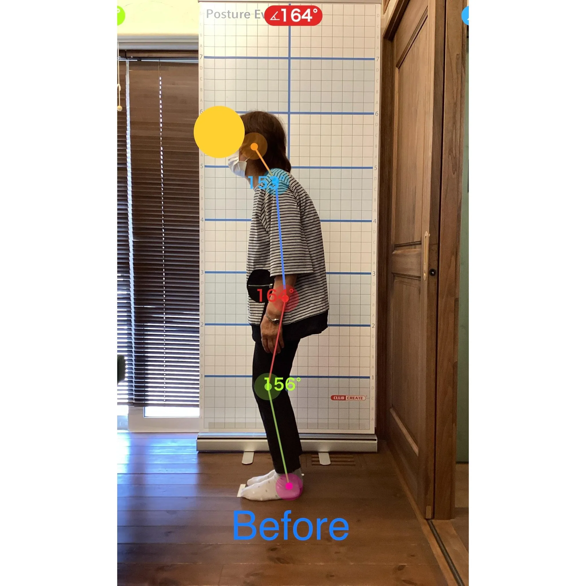 【富里 整体】背中の痛み、腰痛、姿勢改善 他/70代女性/農...