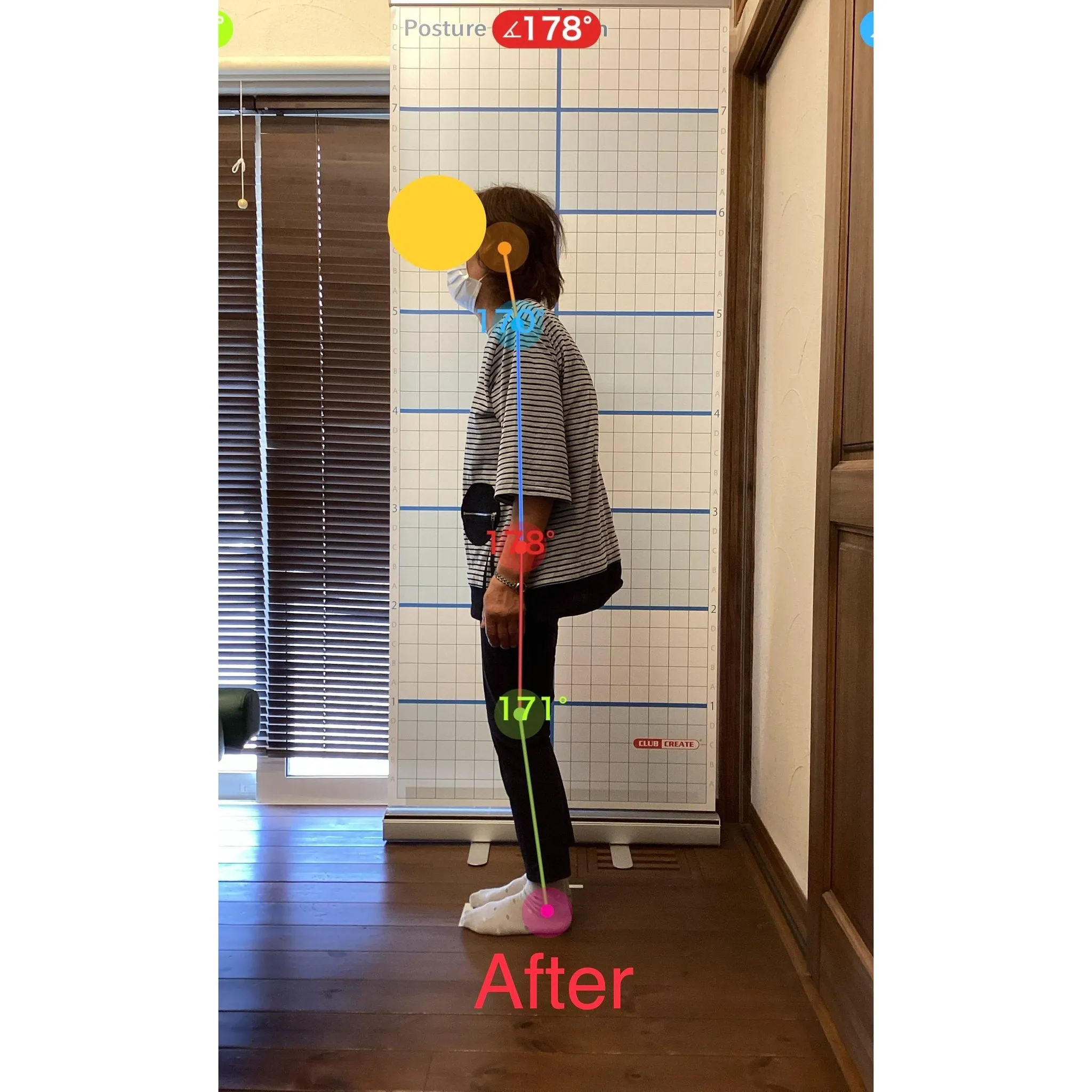 【富里 整体】背中の痛み、腰痛、姿勢改善 他/70代女性/農...