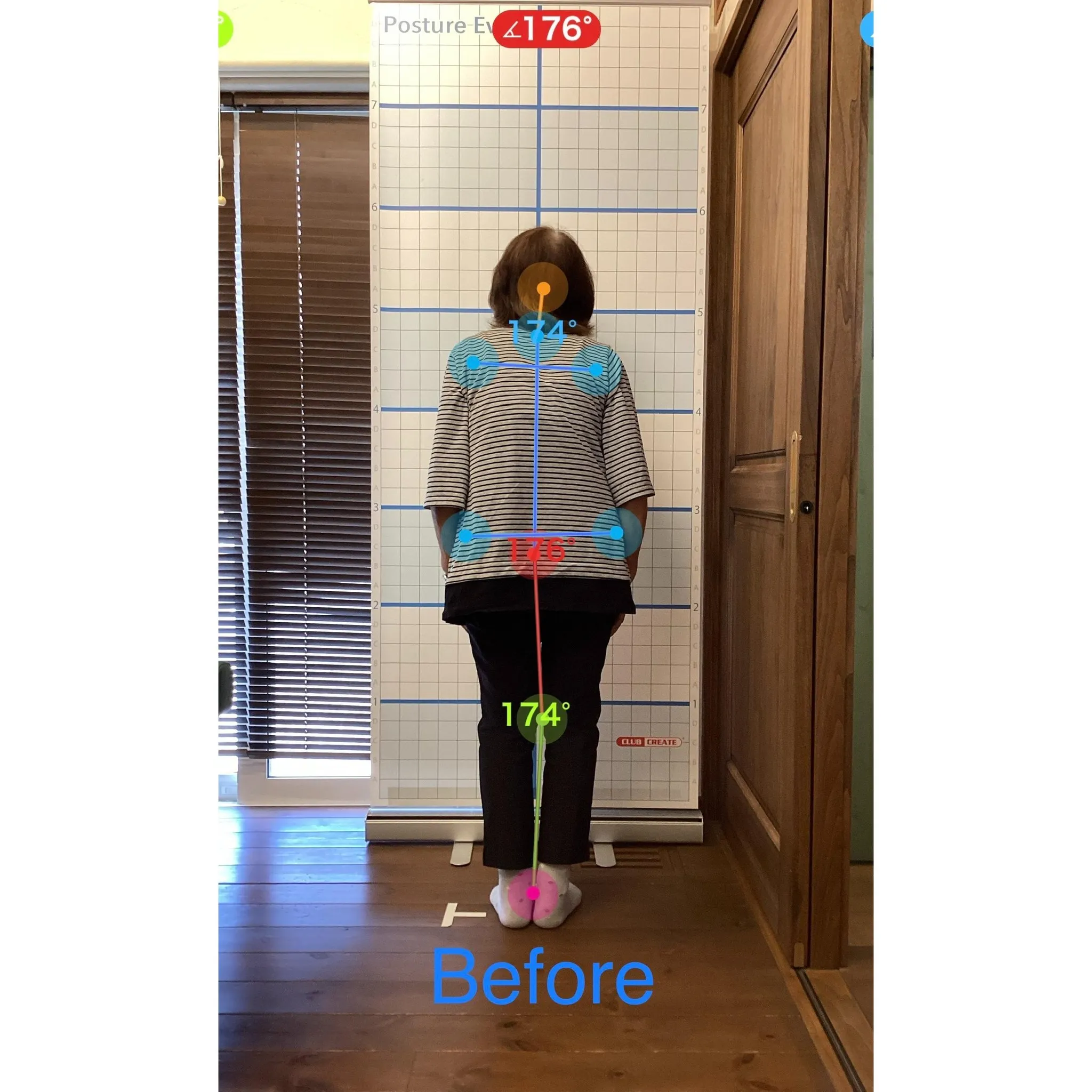 【富里 整体】背中の痛み、腰痛、姿勢改善 他/70代女性/農...