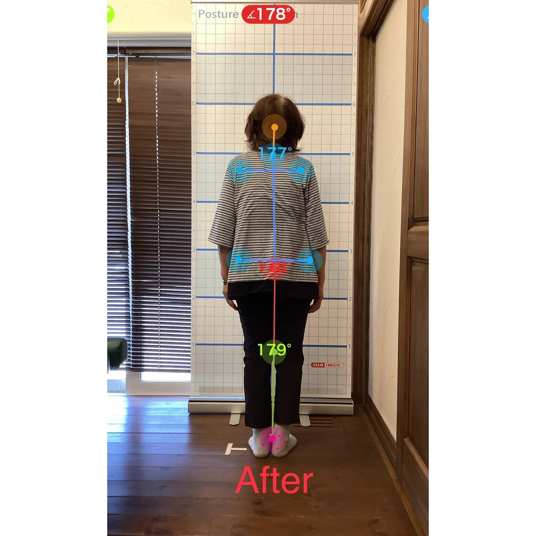 【富里 整体】背中の痛み、腰痛、姿勢改善 他/70代女性/農...