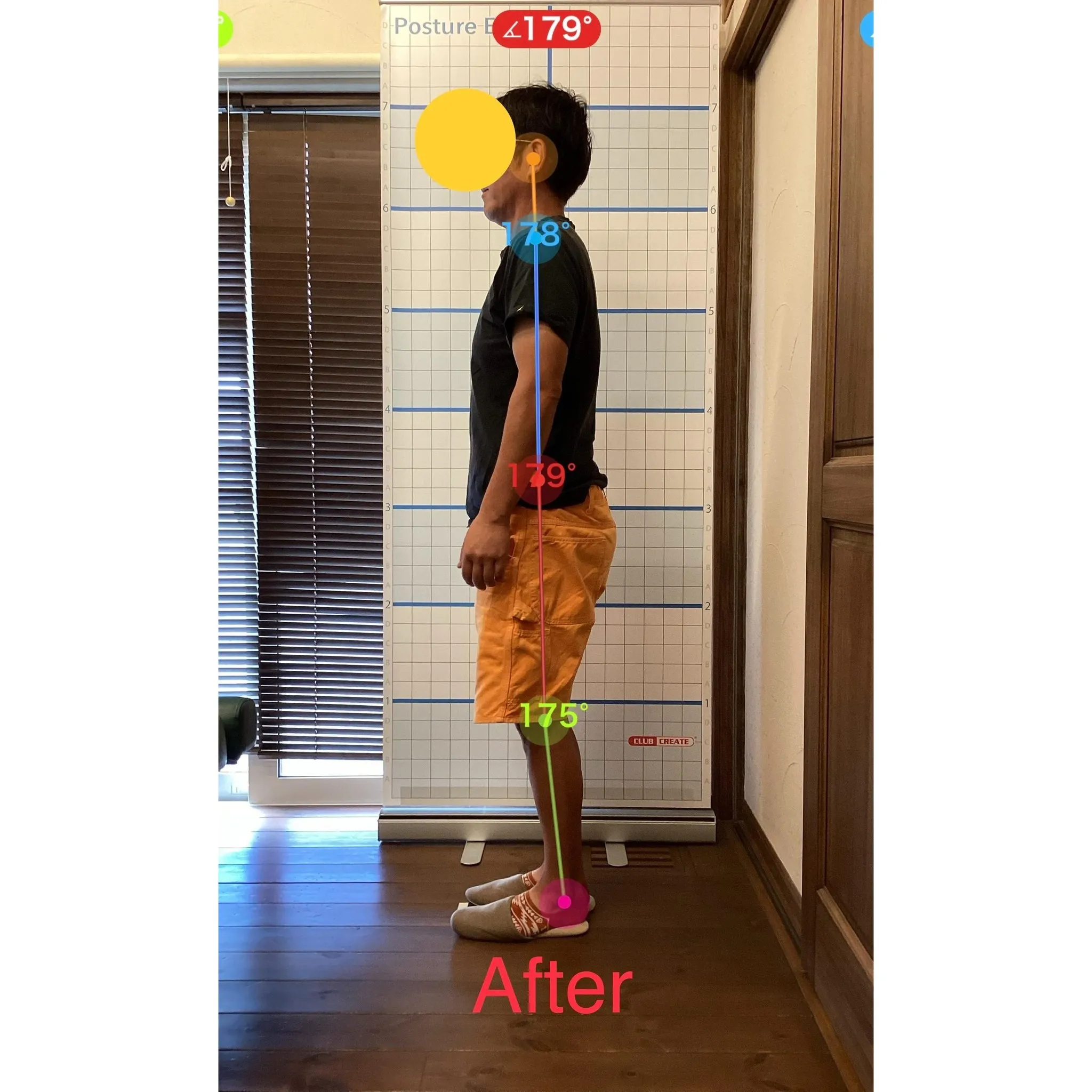 【富里 整体】腰痛、背中の痛み、肩こり 他/50代男性/観光...