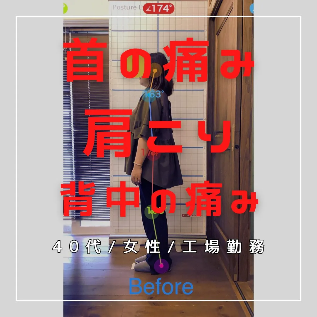 【富里 整体】首の痛み、肩こり、背中の痛み 他/40代女性/...