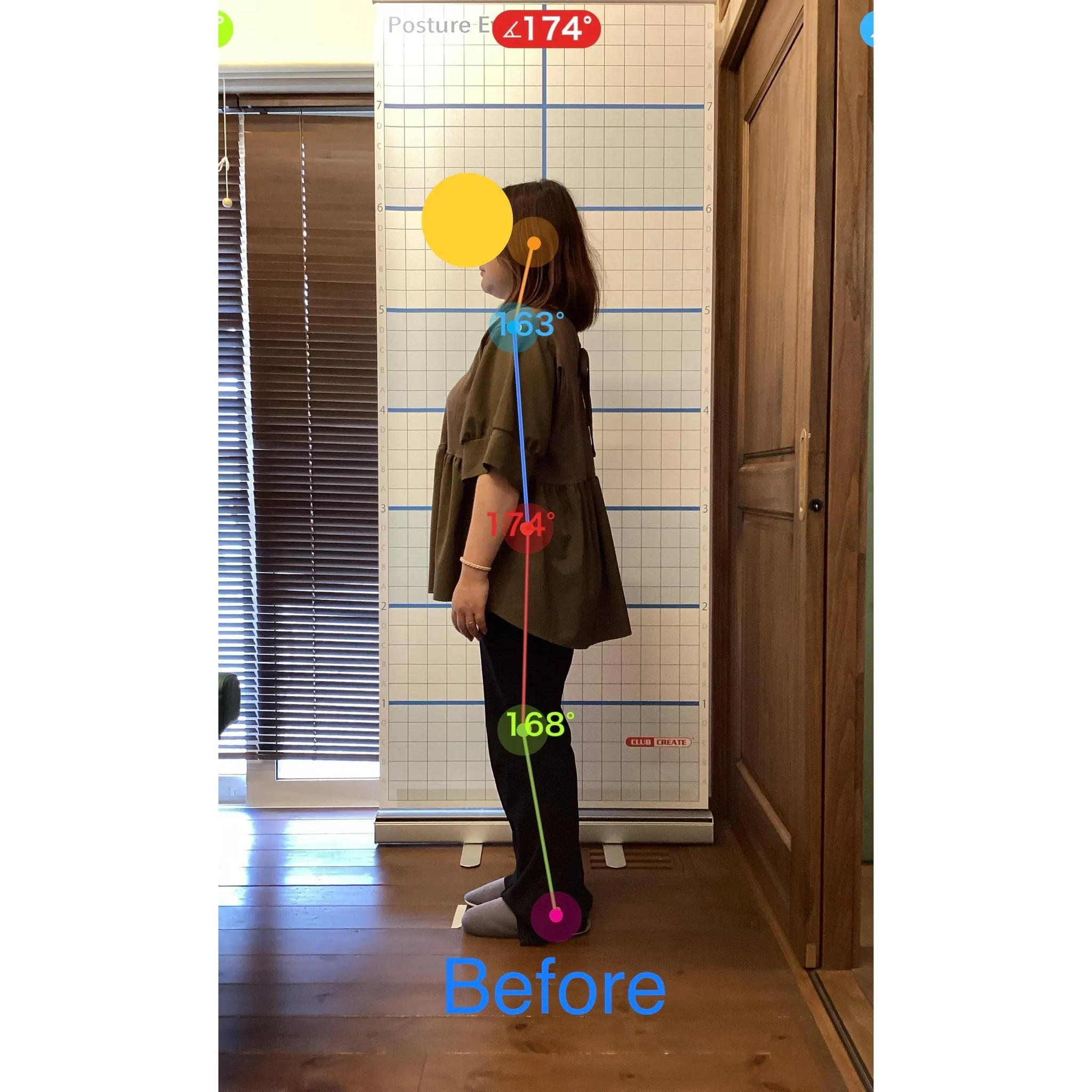 【富里 整体】首の痛み、肩こり、背中の痛み 他/40代女性/...