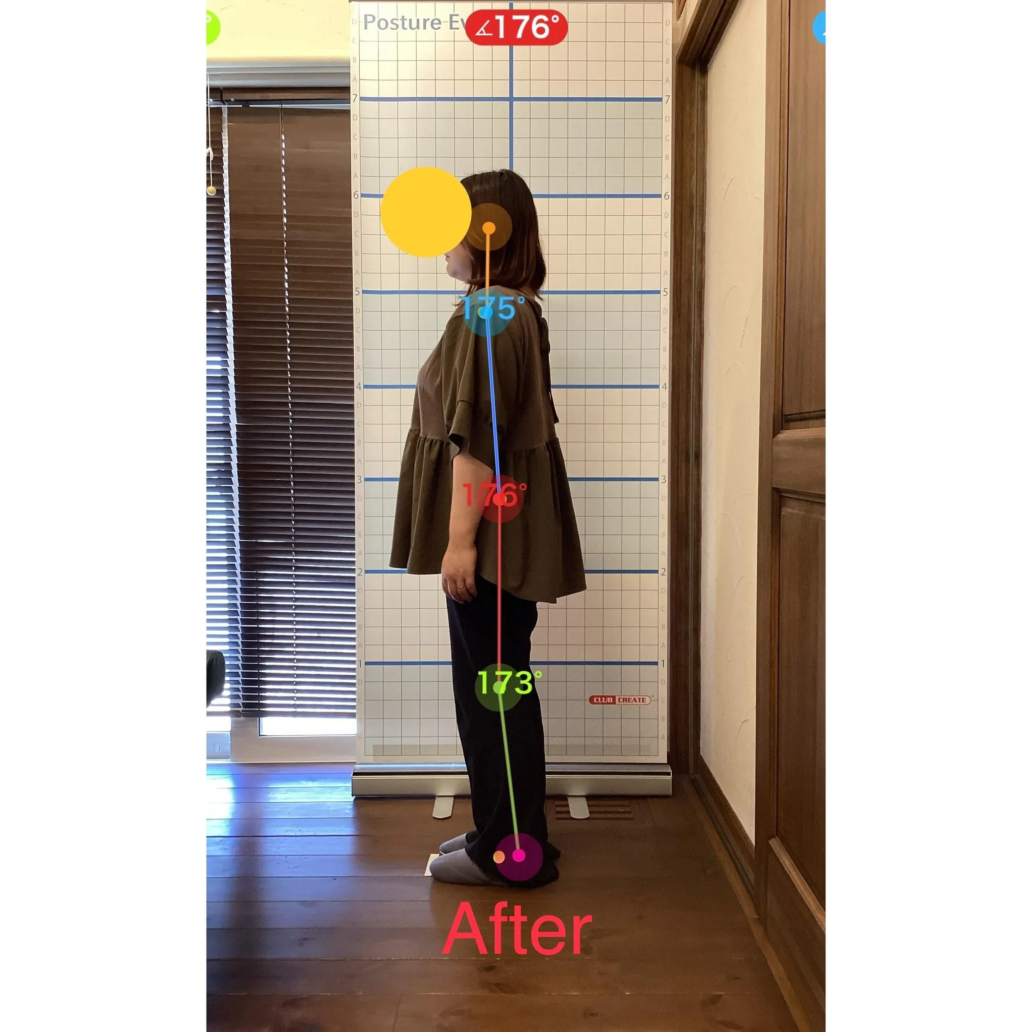 【富里 整体】首の痛み、肩こり、背中の痛み 他/40代女性/...