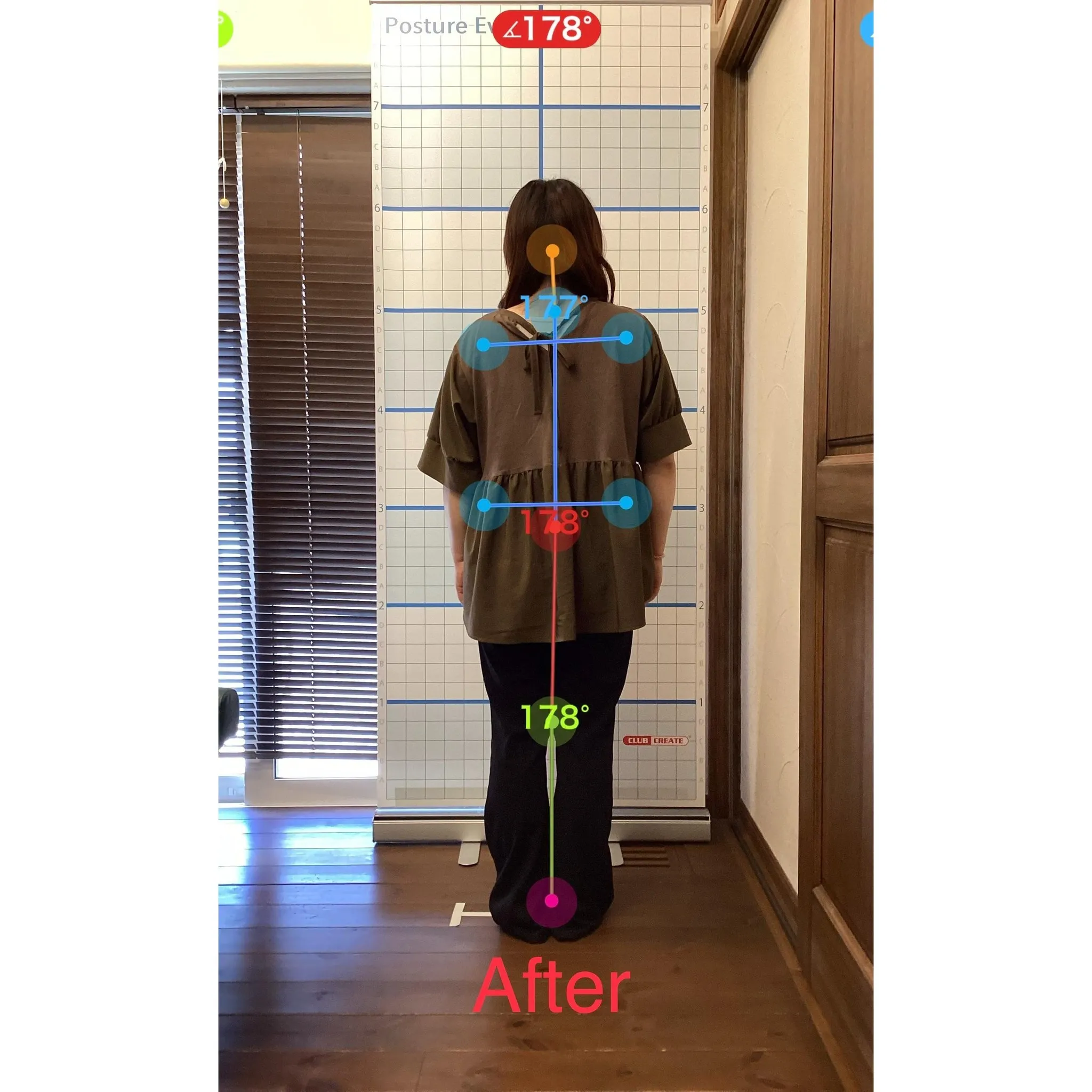 【富里 整体】首の痛み、肩こり、背中の痛み 他/40代女性/...