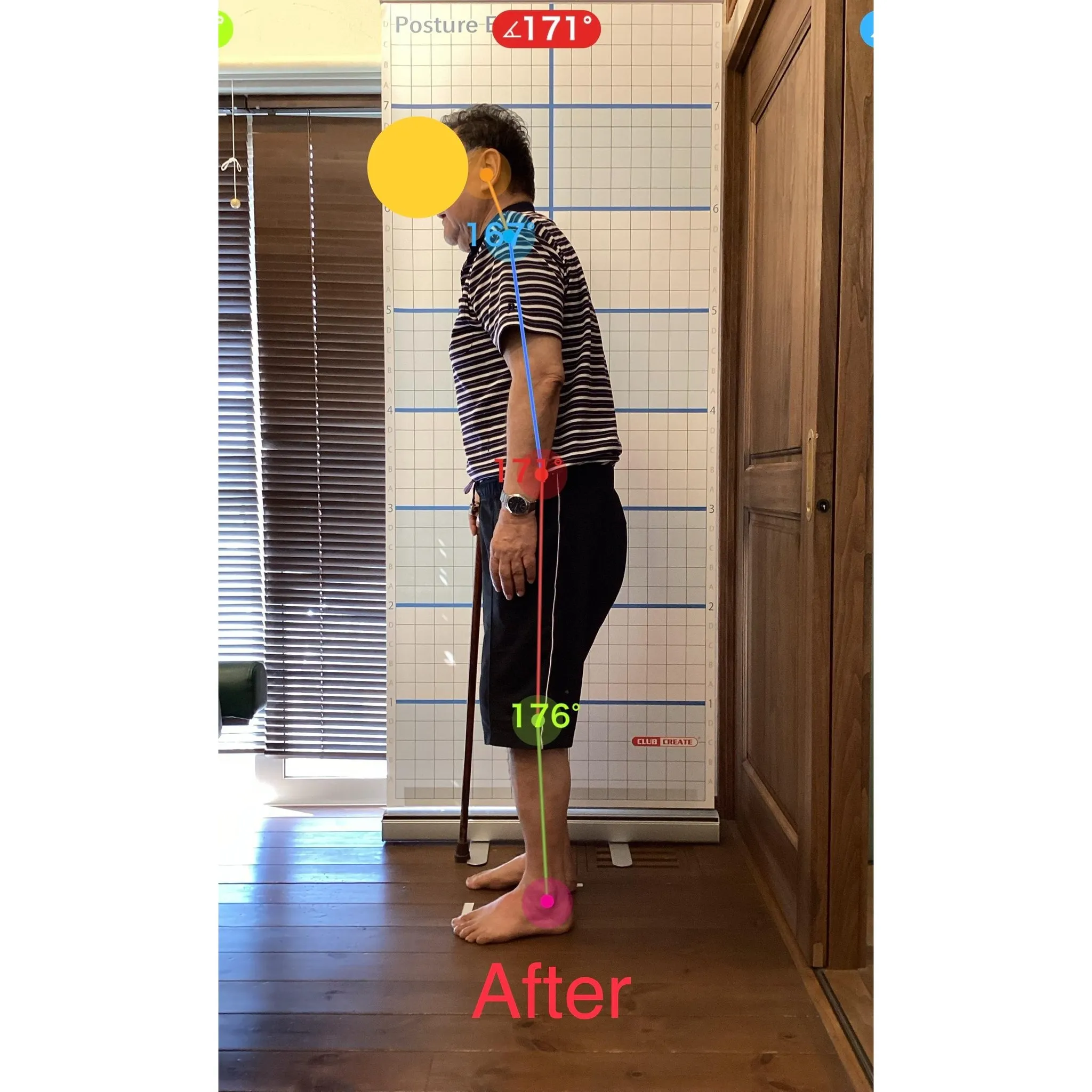 【富里 整体】腰痛、脚のシビレ、坐骨神経痛 他/60代男性/...