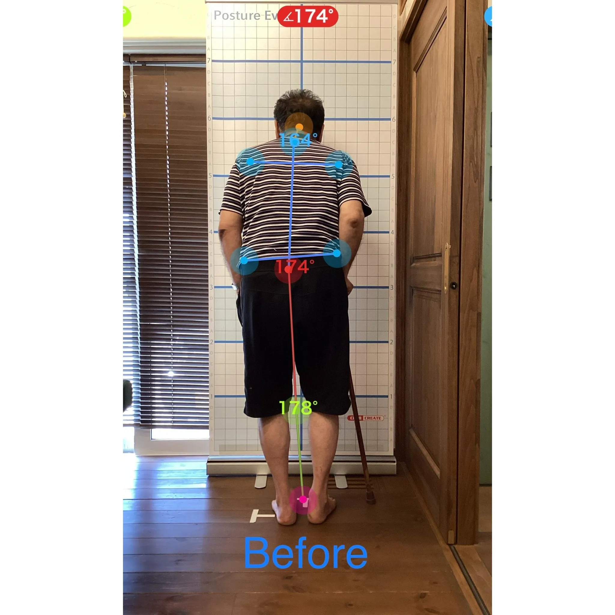 【富里 整体】腰痛、脚のシビレ、坐骨神経痛 他/60代男性/...