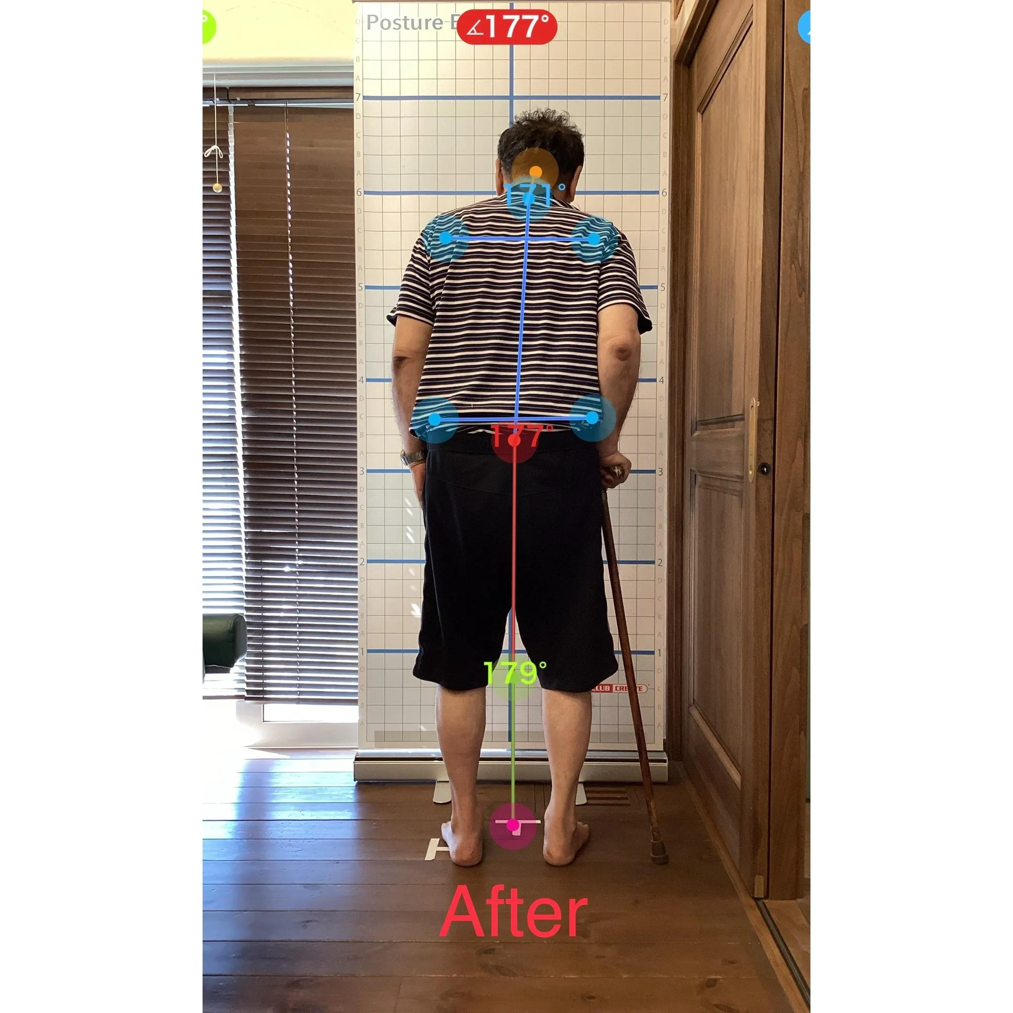 【富里 整体】腰痛、脚のシビレ、坐骨神経痛 他/60代男性/...