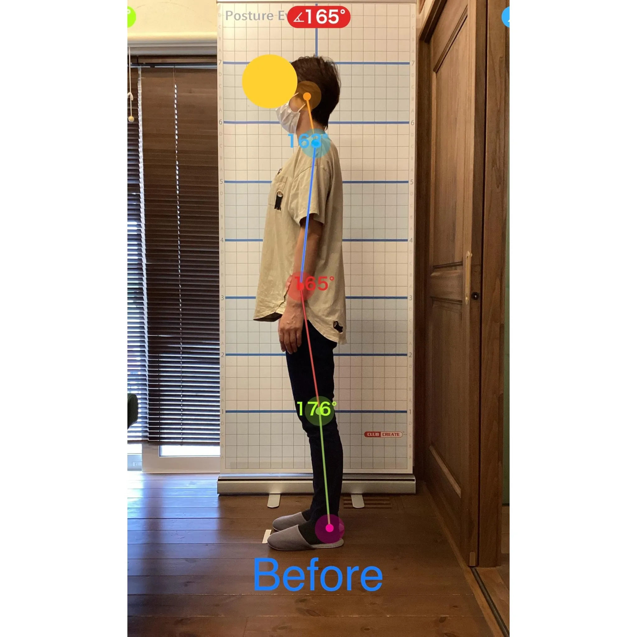 【富里 整体】脊柱管狭窄症、臀部の痛み、左脚の痛み 他/40...