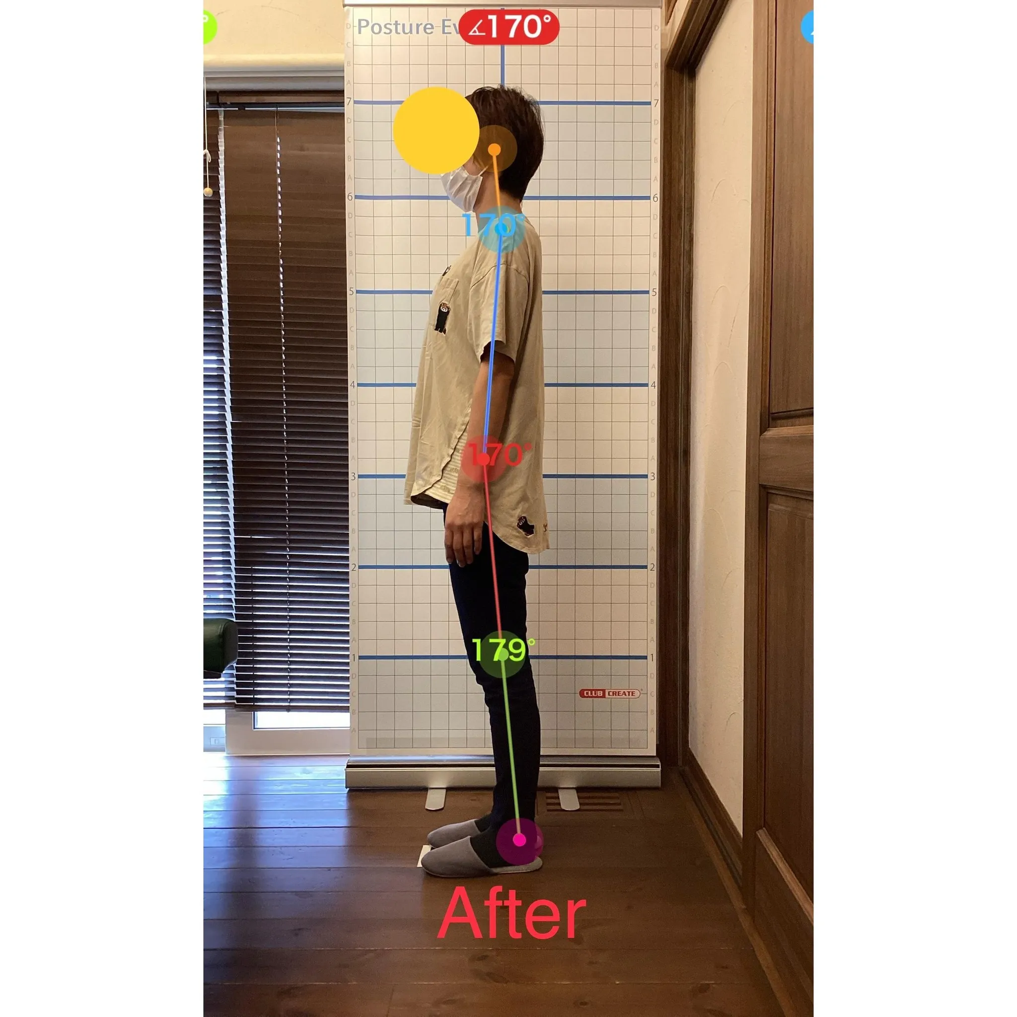 【富里 整体】脊柱管狭窄症、臀部の痛み、左脚の痛み 他/40...