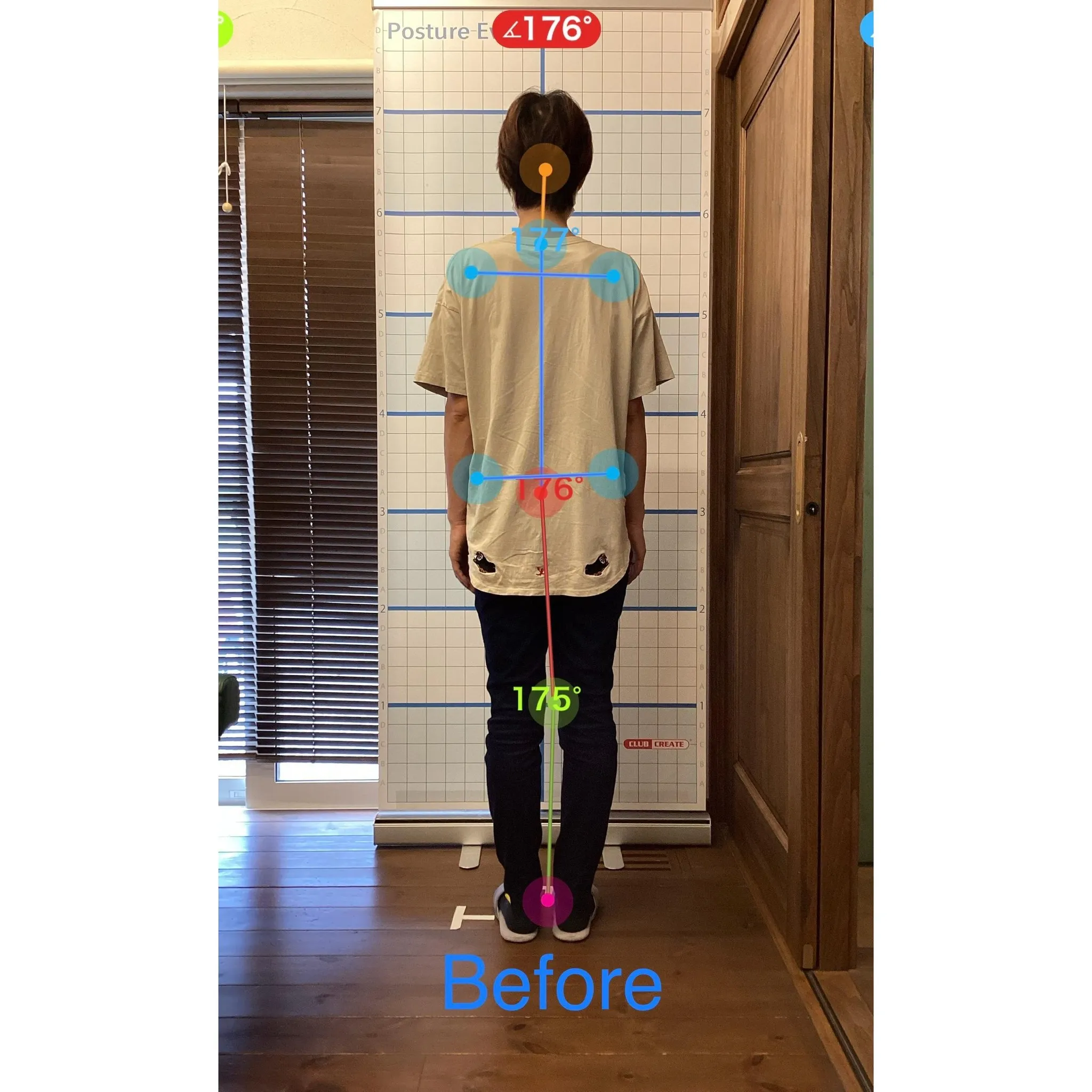 【富里 整体】脊柱管狭窄症、臀部の痛み、左脚の痛み 他/40...