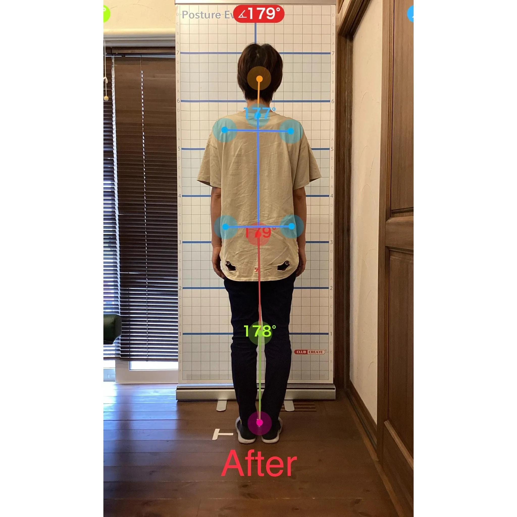 【富里 整体】脊柱管狭窄症、臀部の痛み、左脚の痛み 他/40...