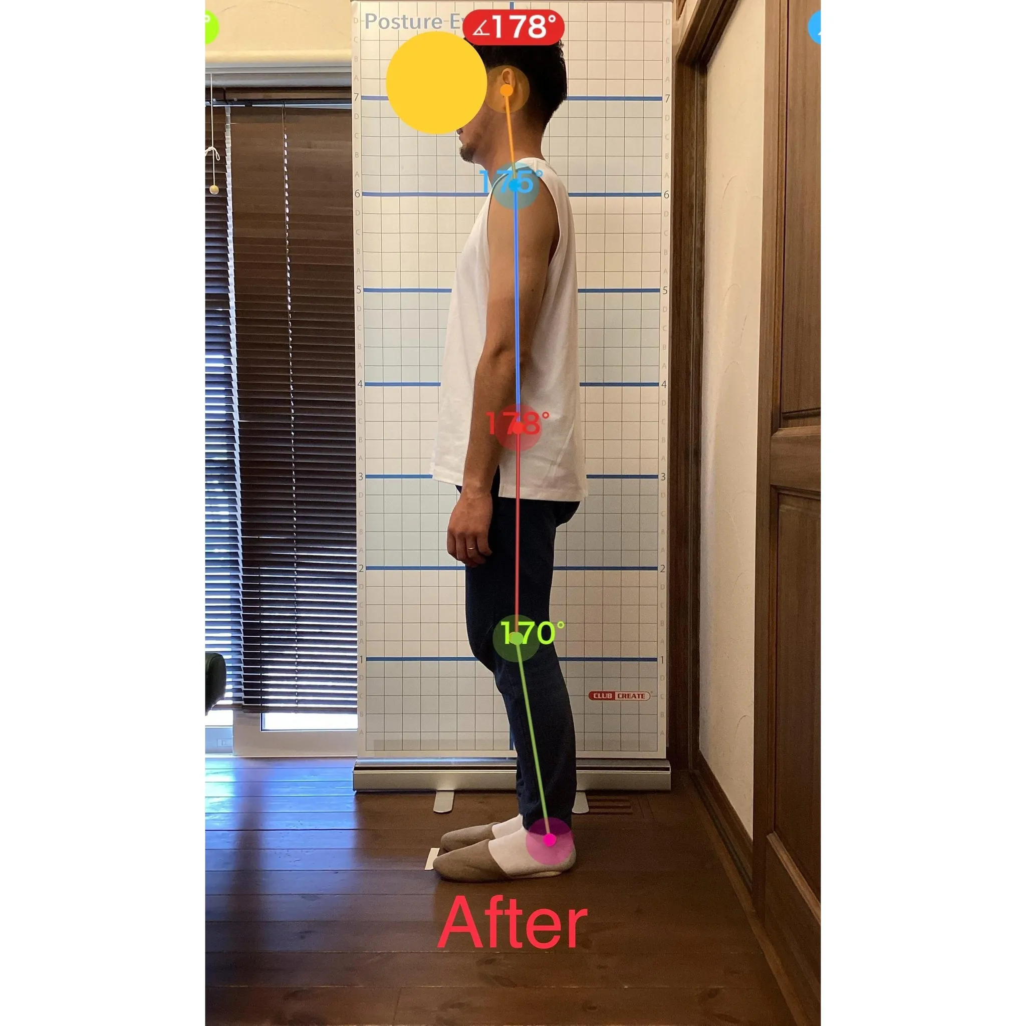 【富里 整体】腰痛/30代男性/会社員