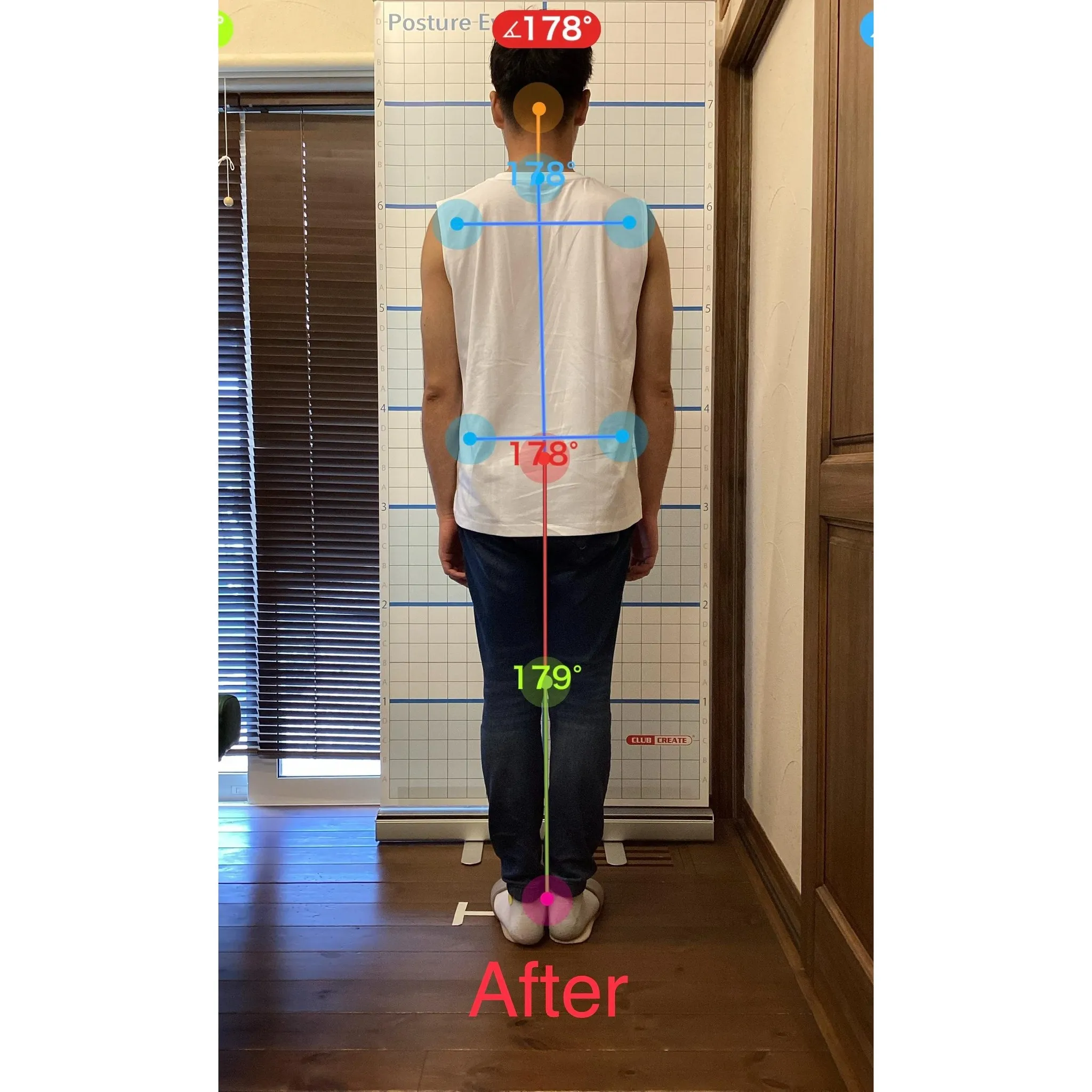 【富里 整体】腰痛/30代男性/会社員