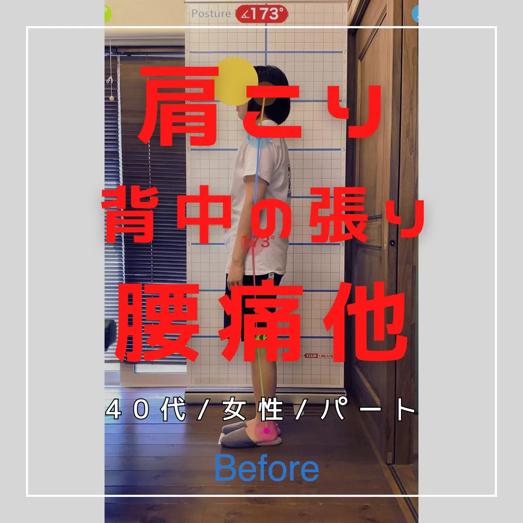 【富里 整体】腰痛、肩こり、背中の張り 他/20代女性/会社...