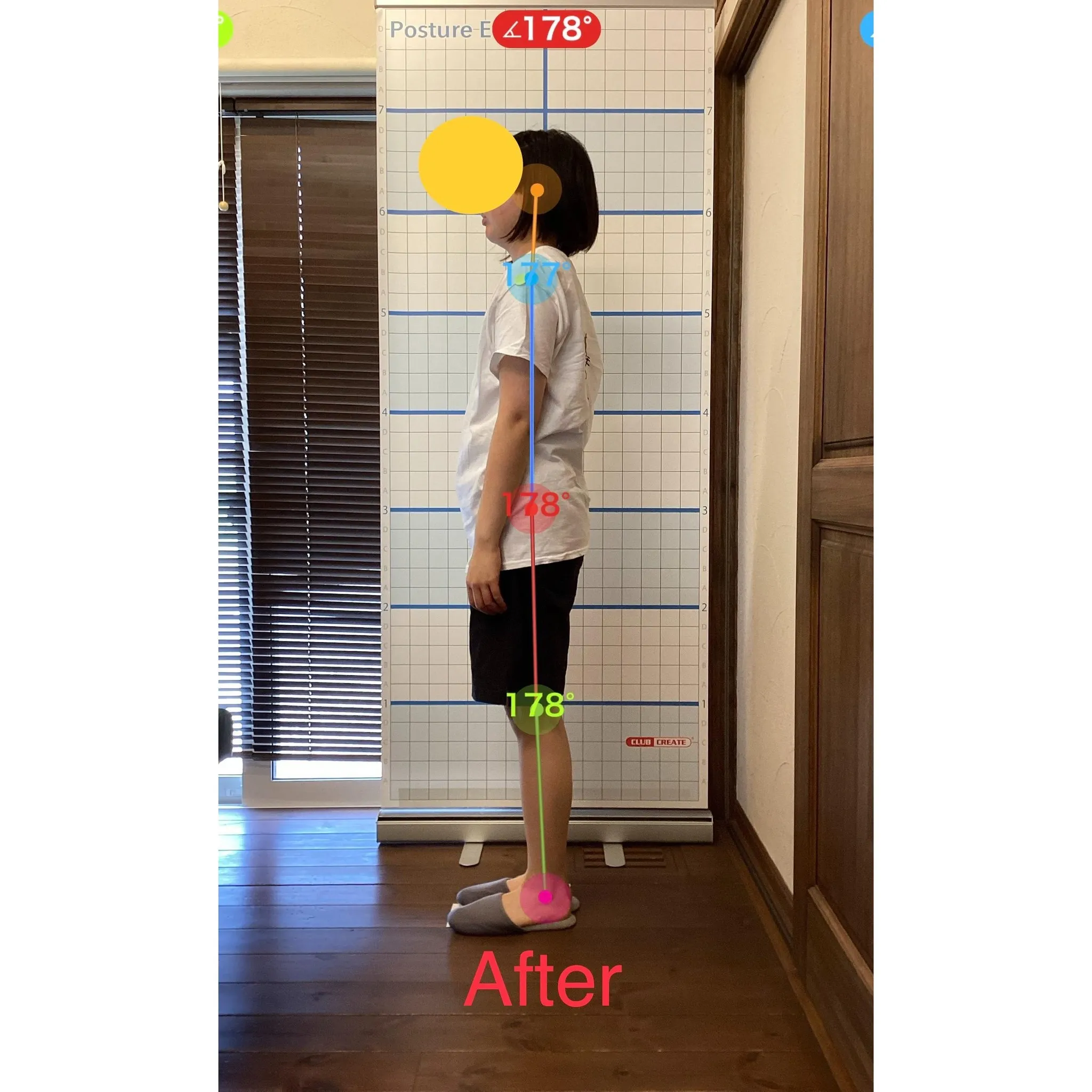 【富里 整体】腰痛、肩こり、背中の張り 他/20代女性/会社...