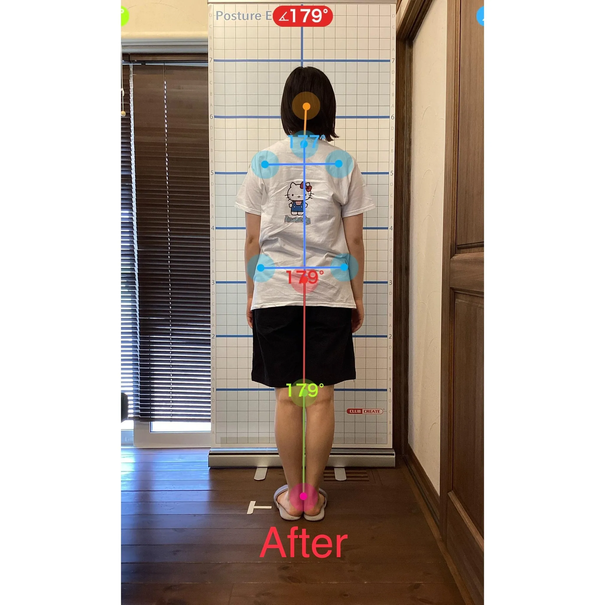 【富里 整体】腰痛、肩こり、背中の張り 他/20代女性/会社...