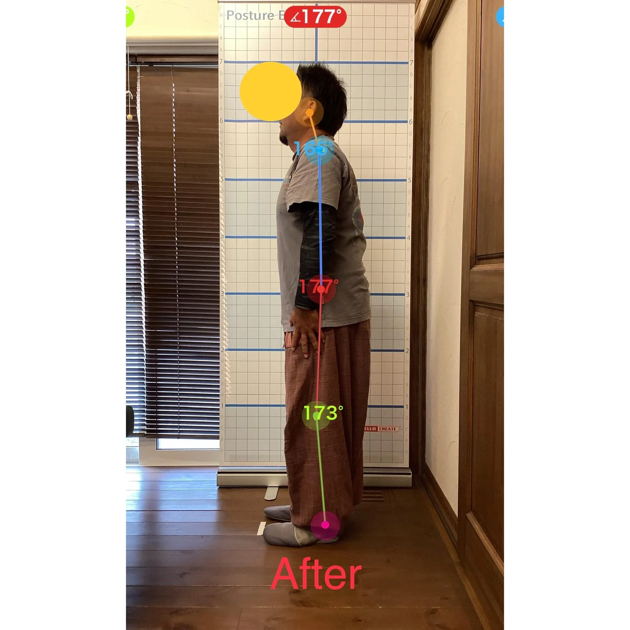 【富里 整体】ギックリ腰、慢性腰痛、臀部の痛み 他/40代男...