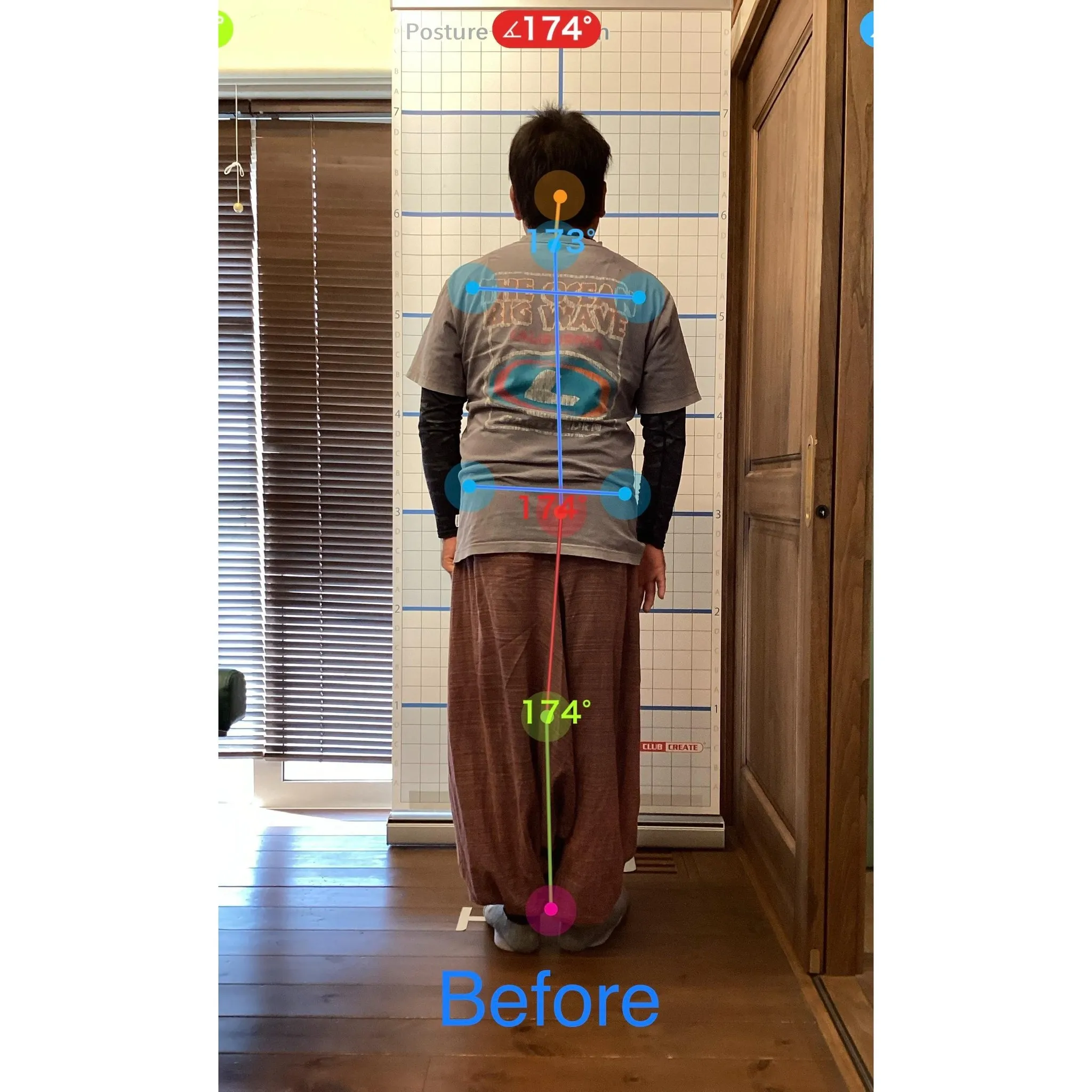 【富里 整体】ギックリ腰、慢性腰痛、臀部の痛み 他/40代男...