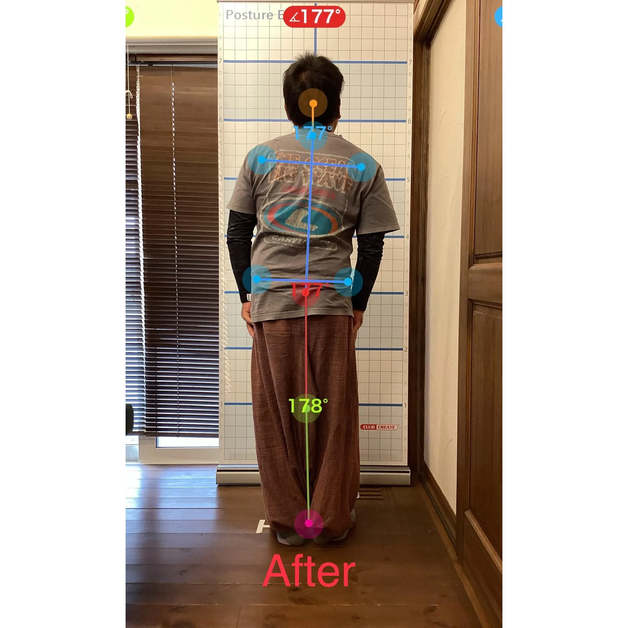 【富里 整体】ギックリ腰、慢性腰痛、臀部の痛み 他/40代男...